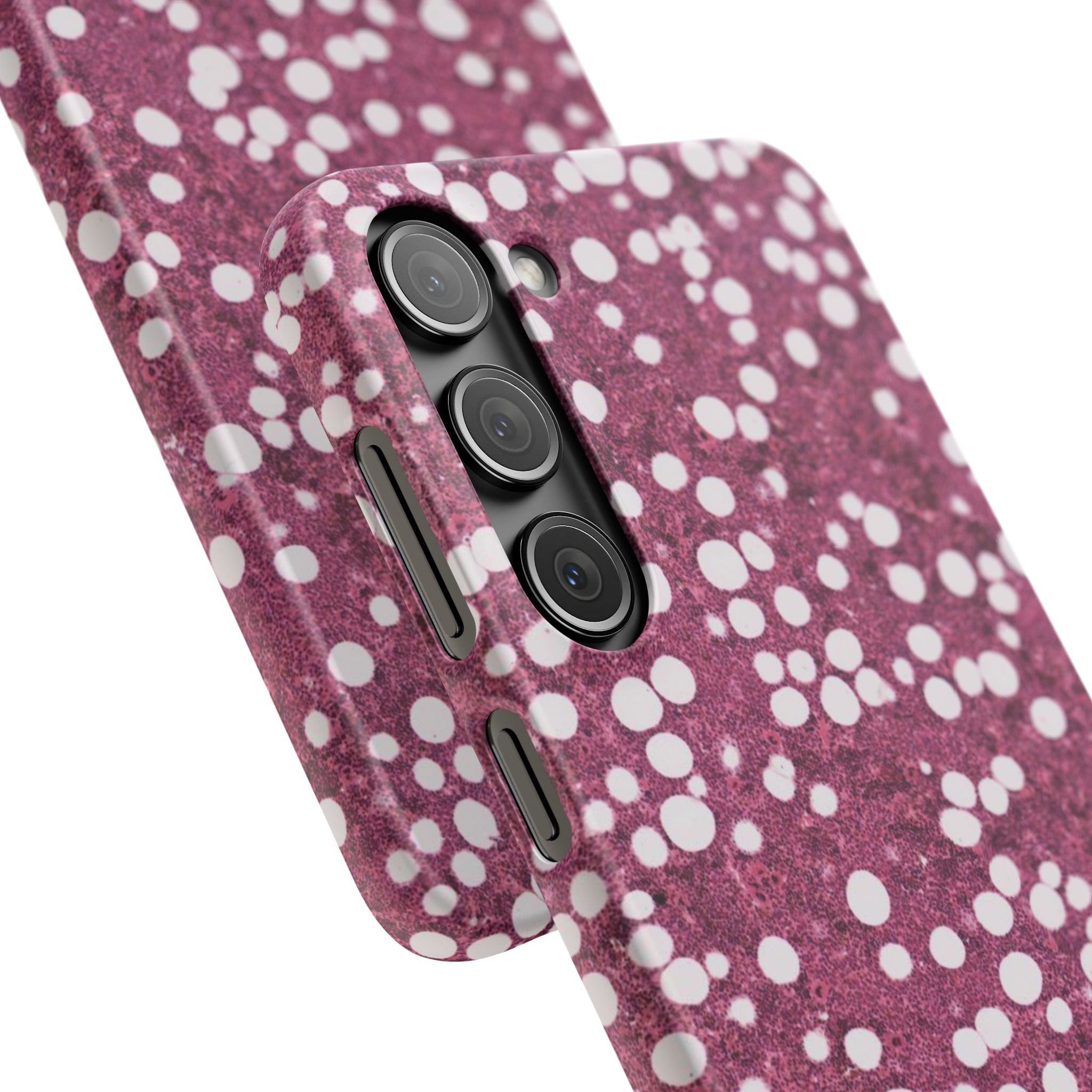 Slim Case Myelolipom