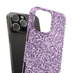Slim Case Paraganglion