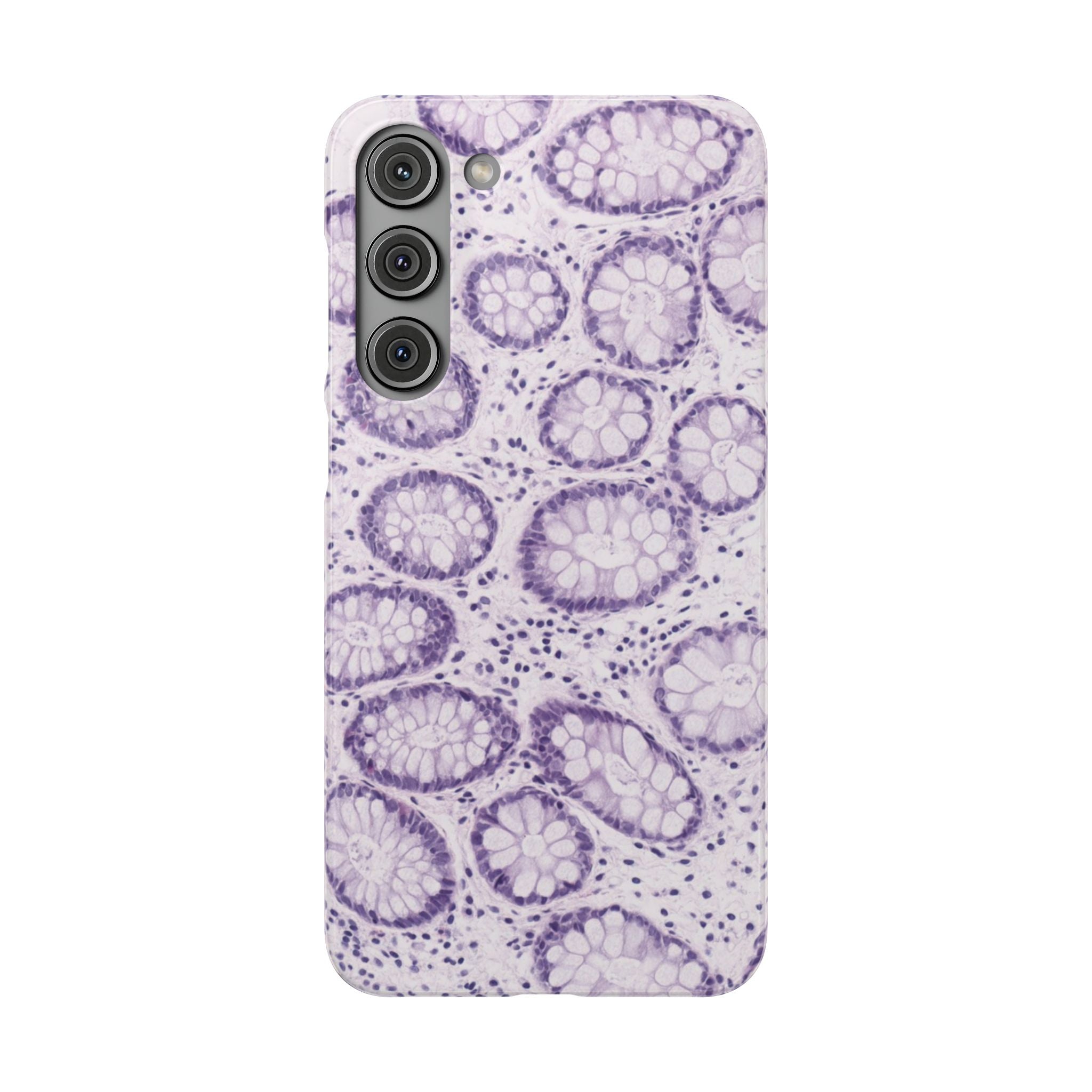 Slim Case Kolon