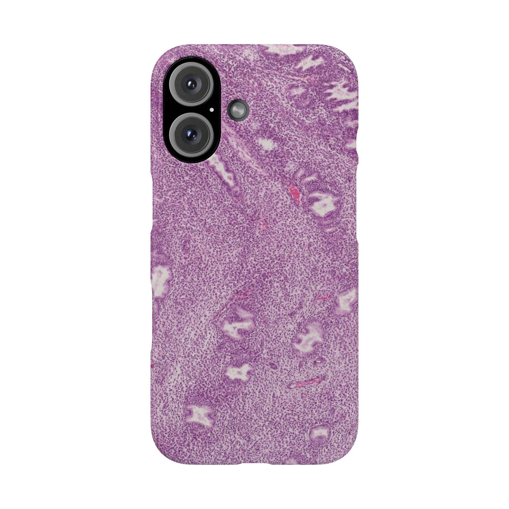Slim Case Endometrium