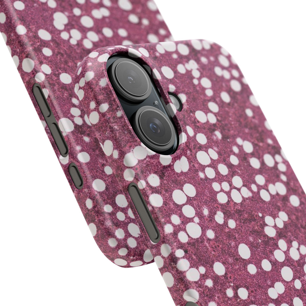 Slim Case Myelolipom