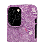 Slim Case Endometrium