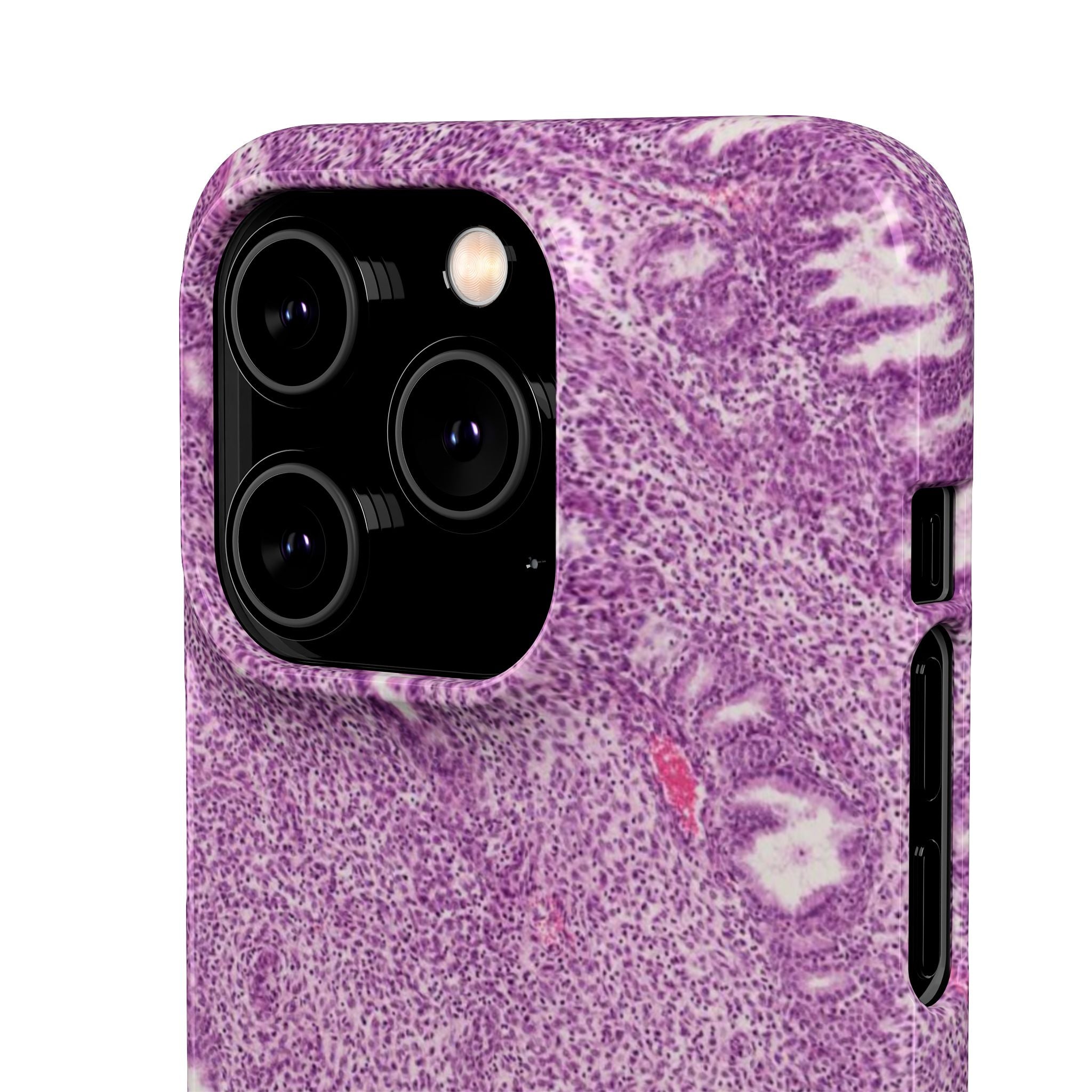 Slim Case Endometrium