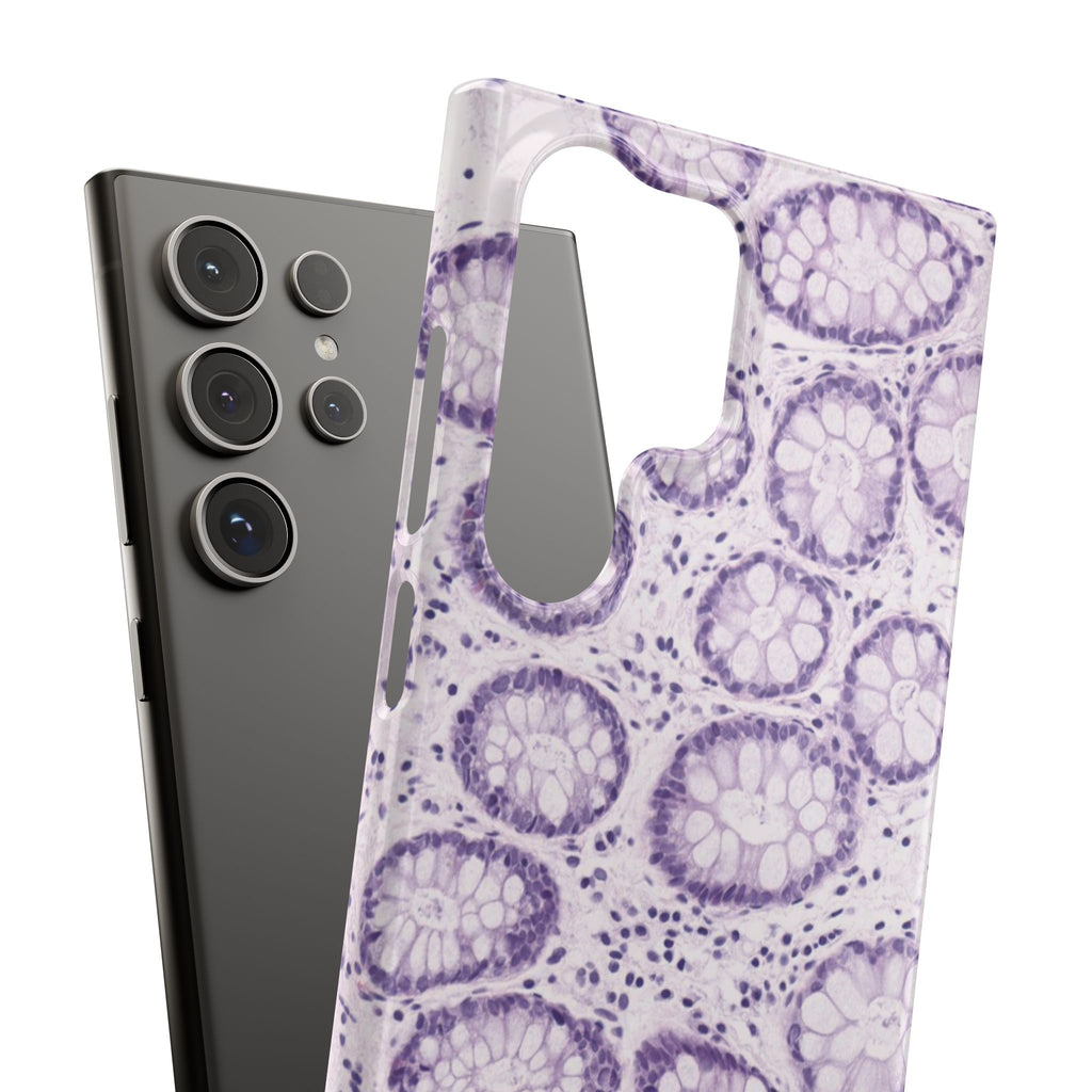 Slim Case Kolon