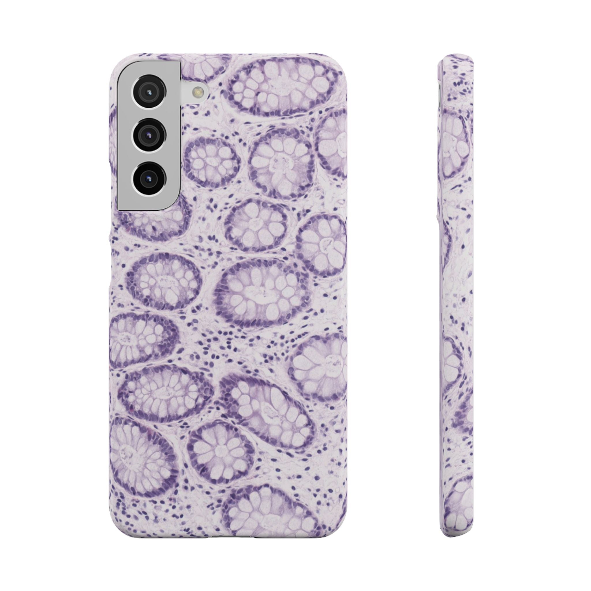 Slim Case Kolon