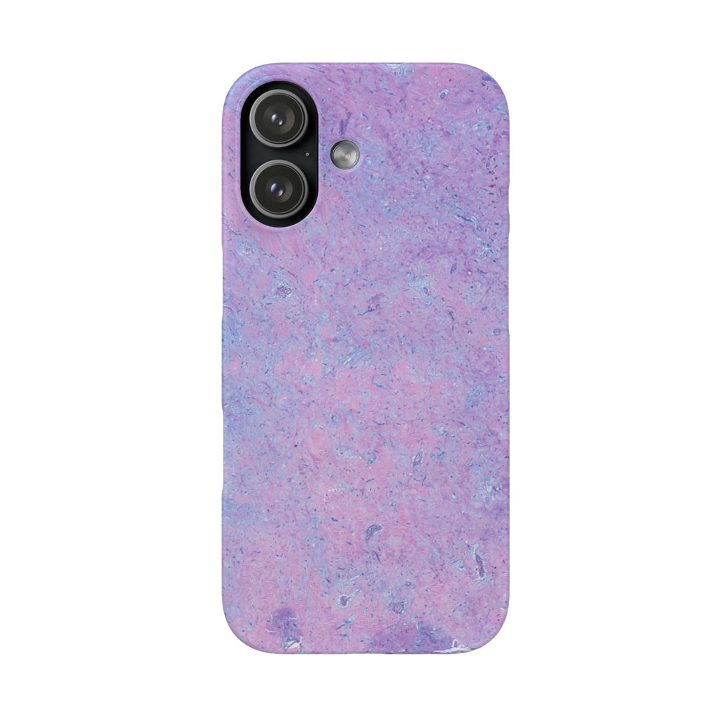 Slim Case Arterielles Myxom
