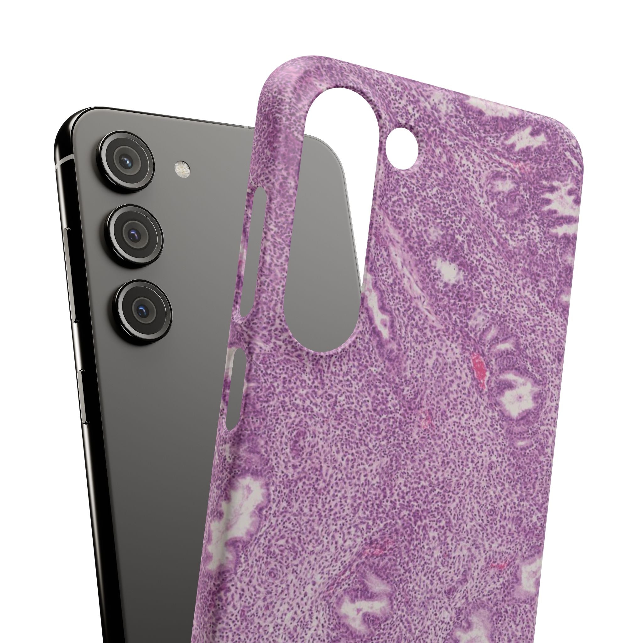 Slim Case Endometrium