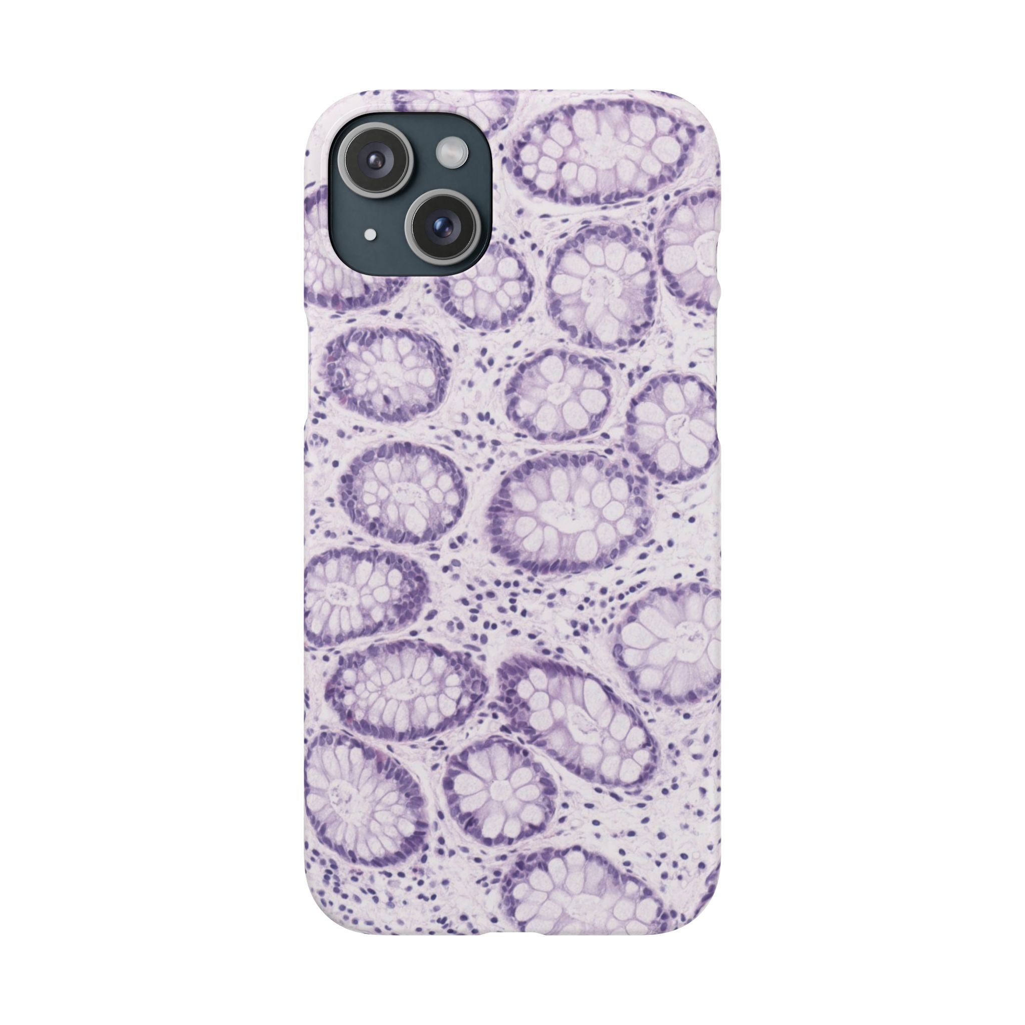 Slim Case Kolon