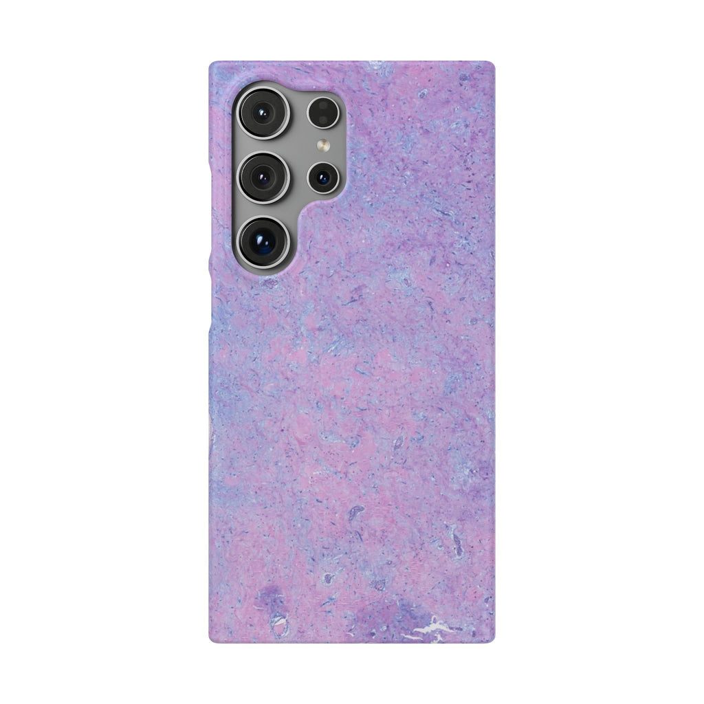 Slim Case Arterielles Myxom