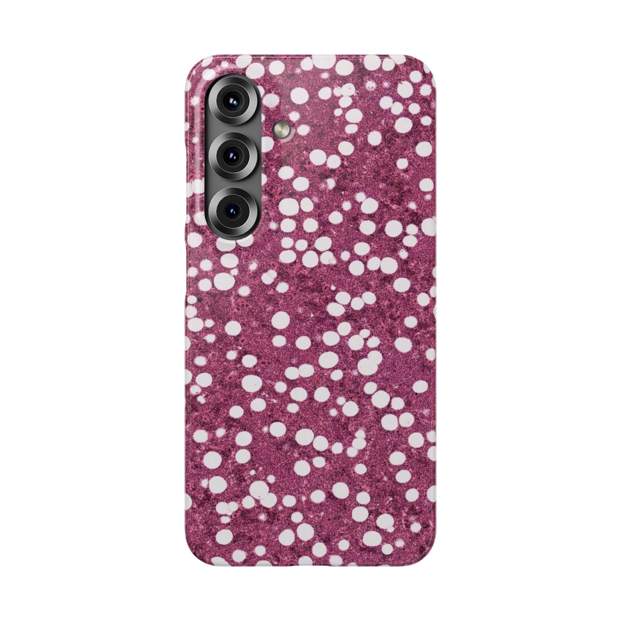 Slim Case Myelolipom