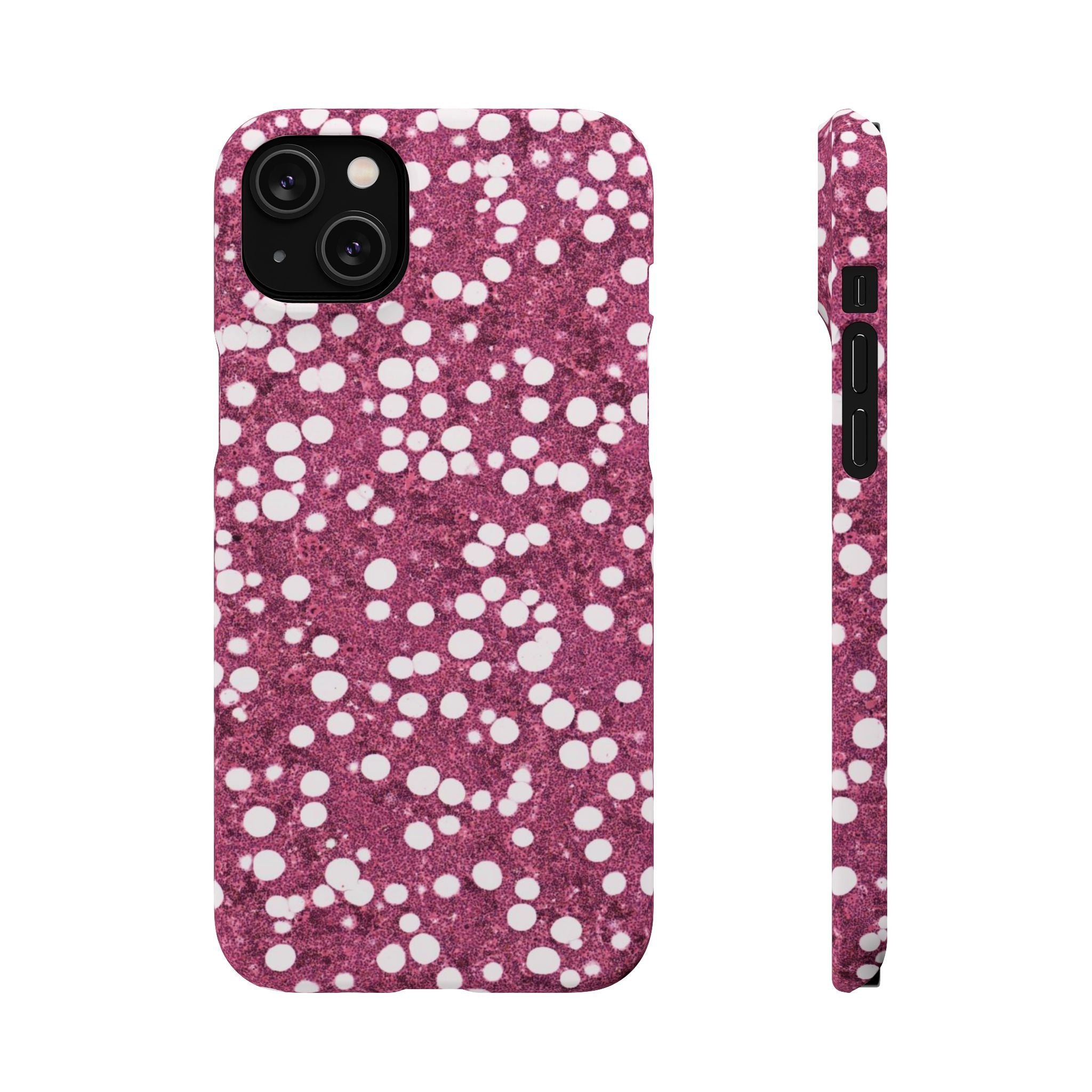 Slim Case Myelolipom