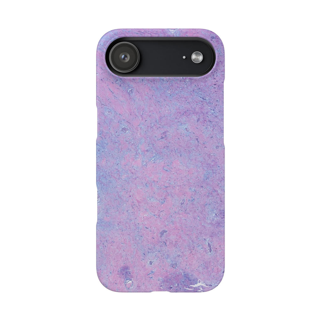 Slim Case Arterielles Myxom
