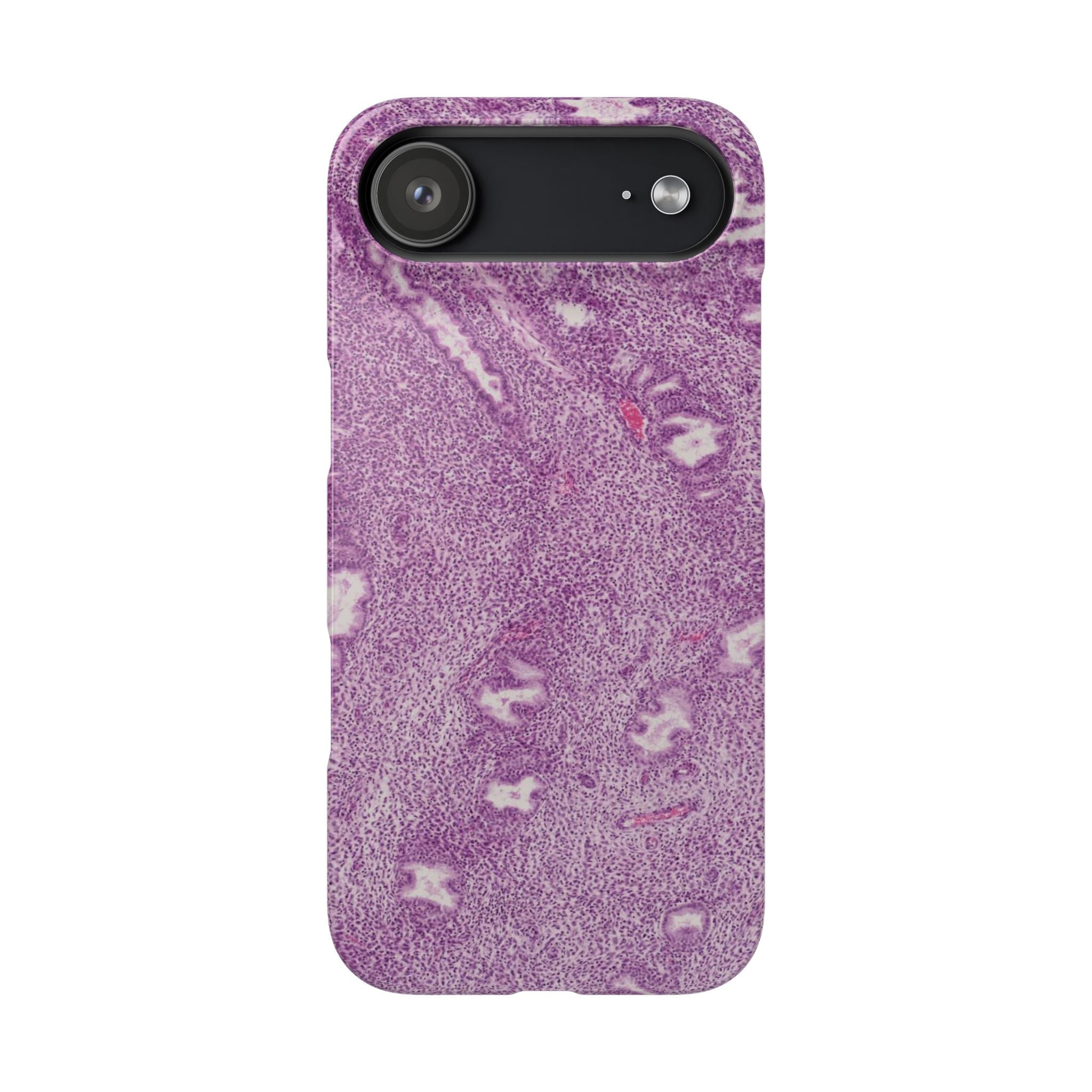 Slim Case Endometrium