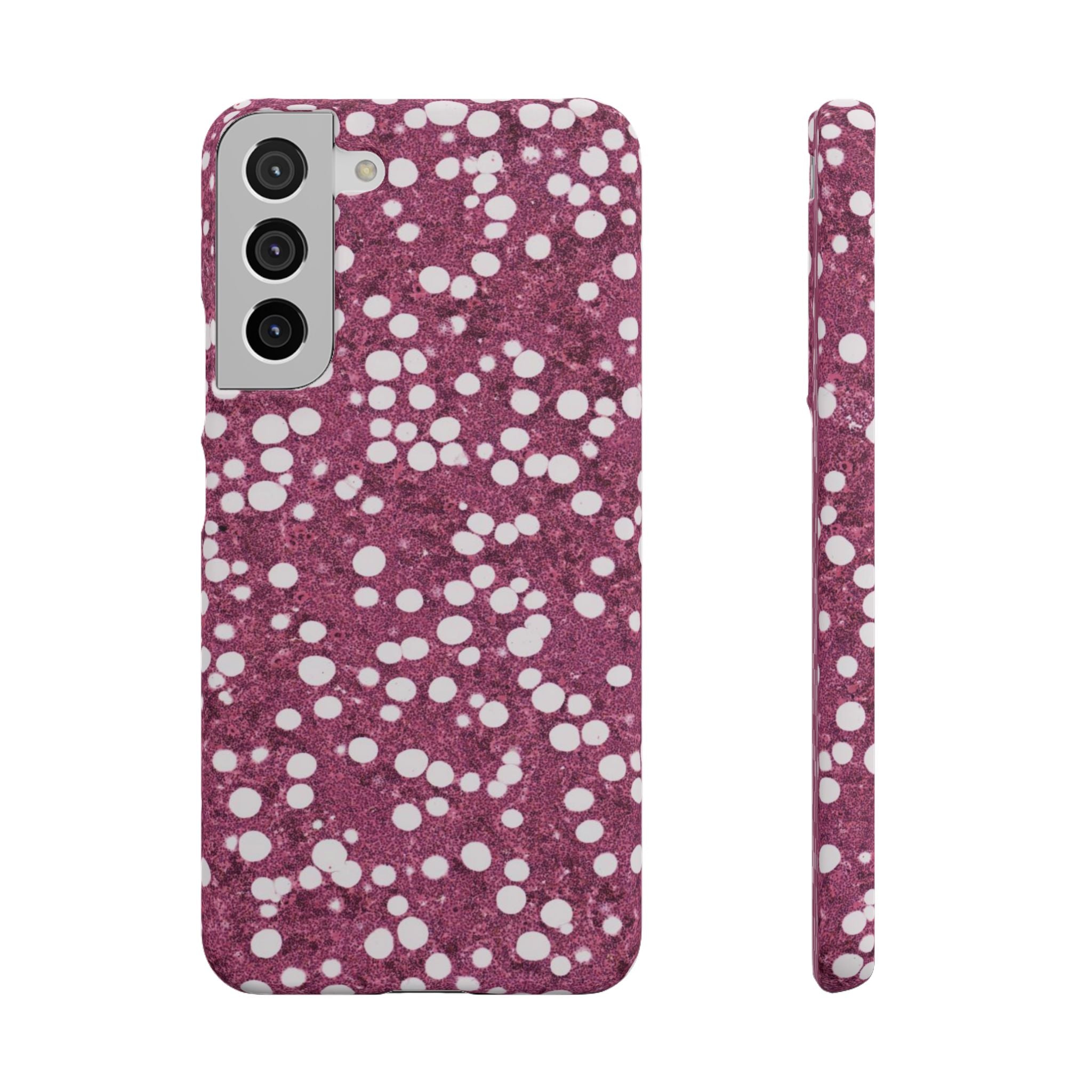 Slim Case Myelolipom
