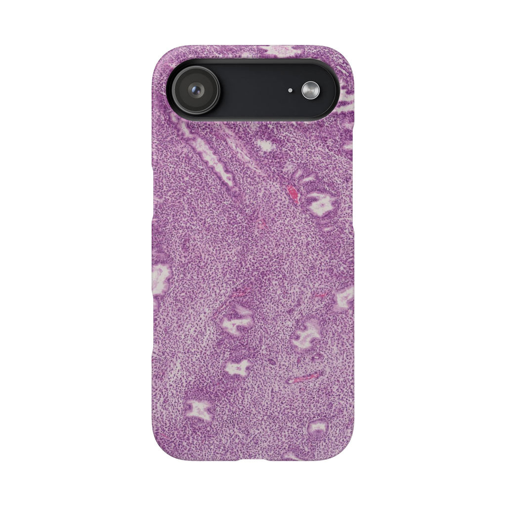 Slim Case Endometrium
