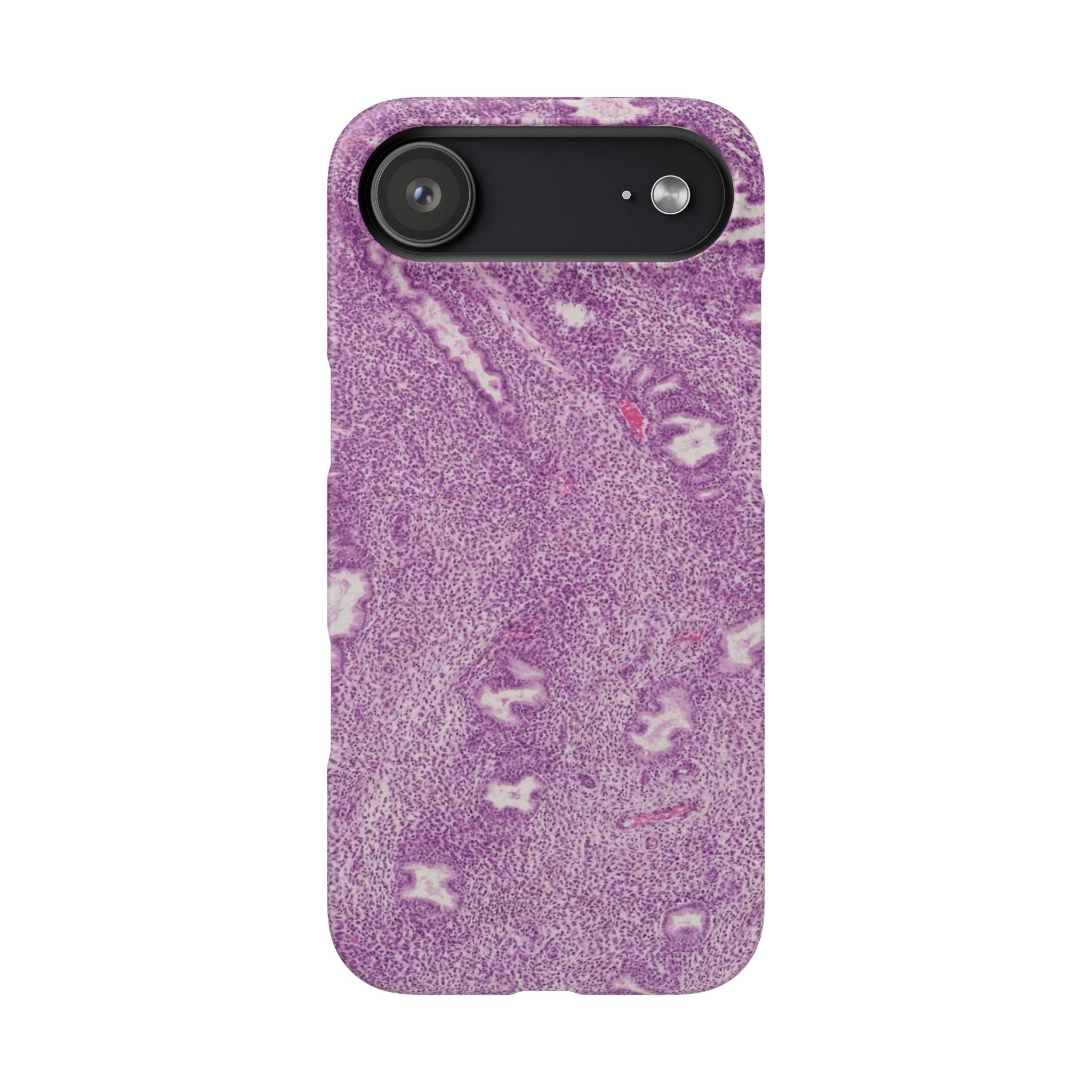 Slim Case Endometrium