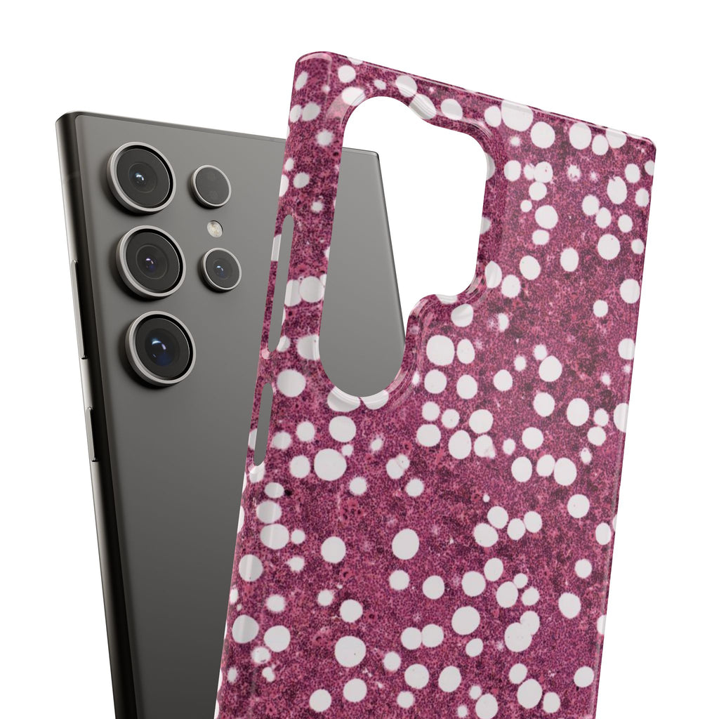 Slim Case Myelolipom