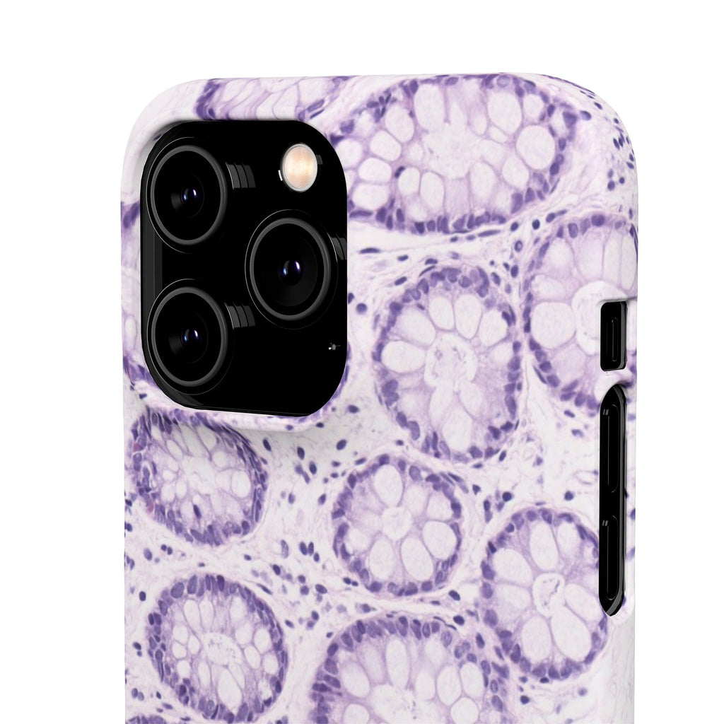 Slim Case Kolon