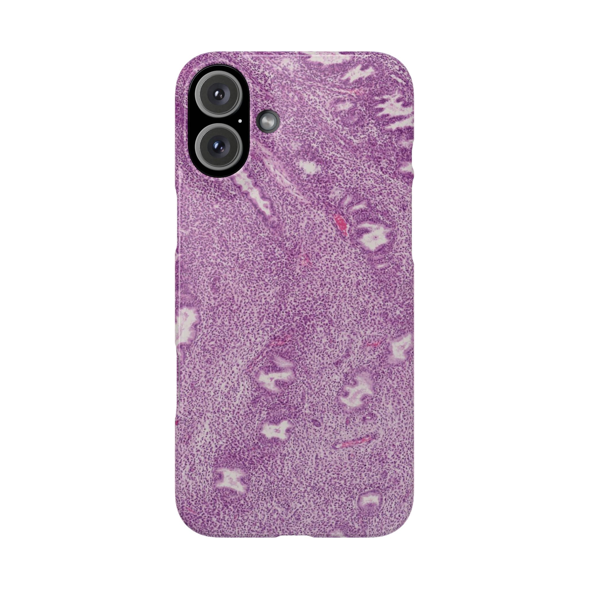 Slim Case Endometrium
