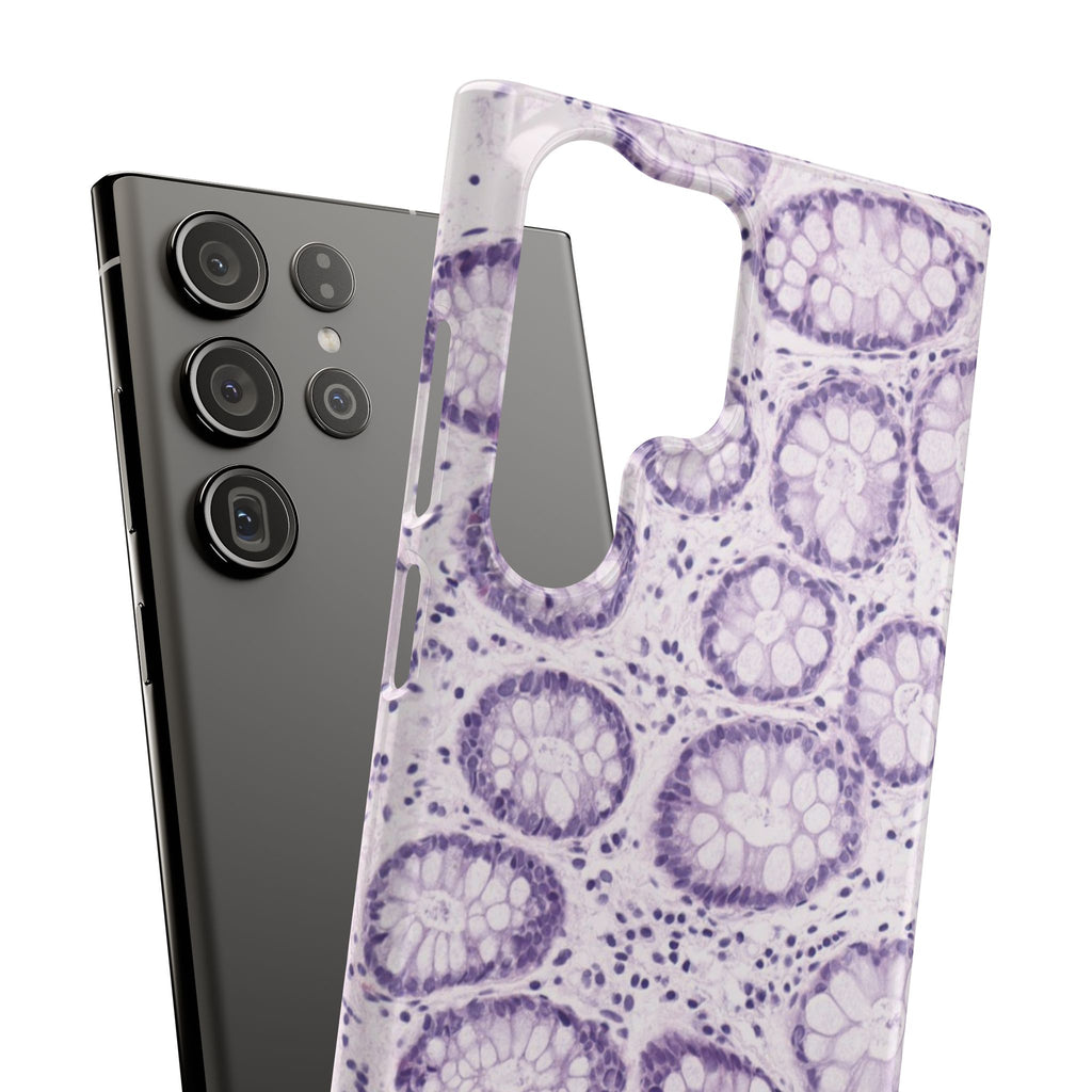 Slim Case Kolon