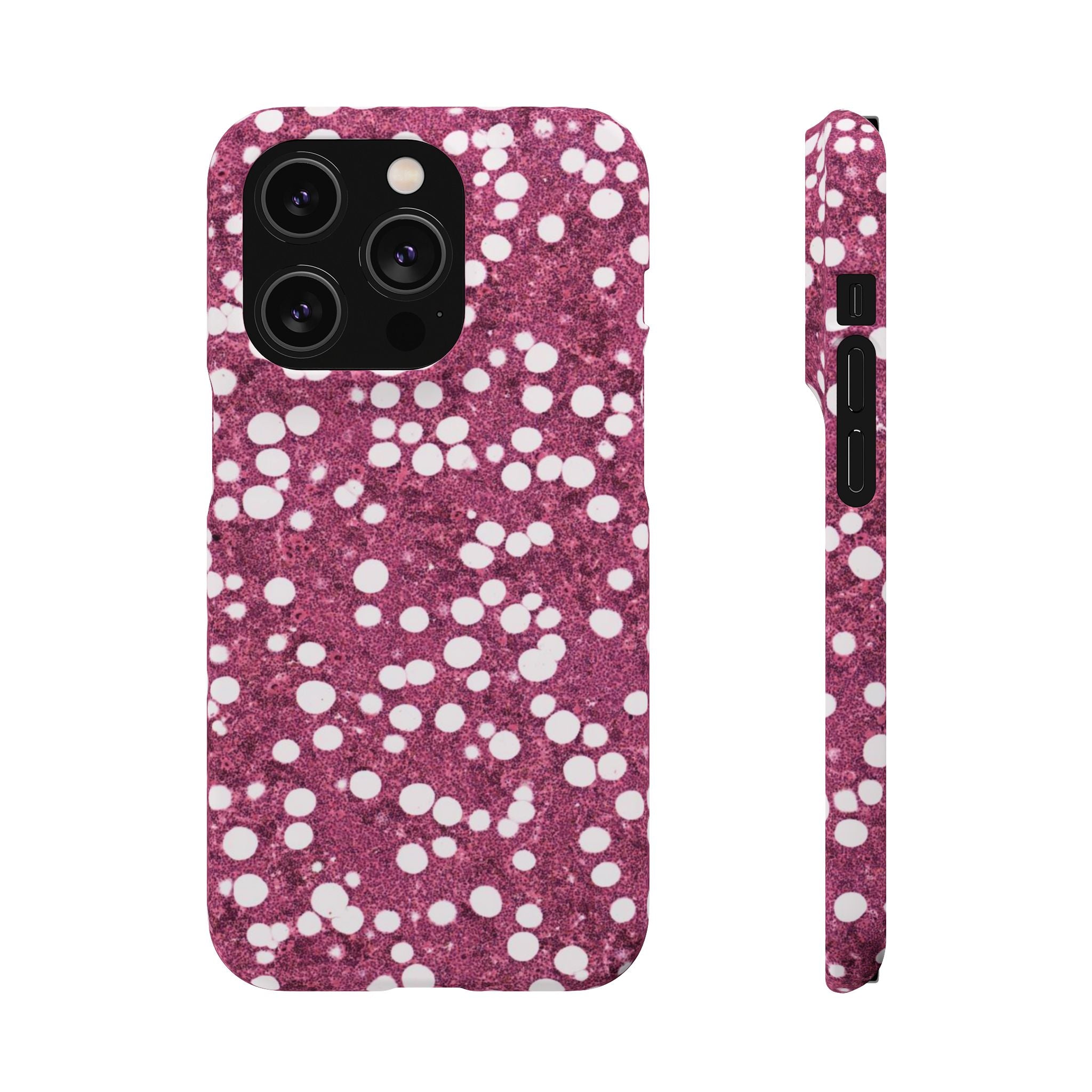 Slim Case Myelolipom
