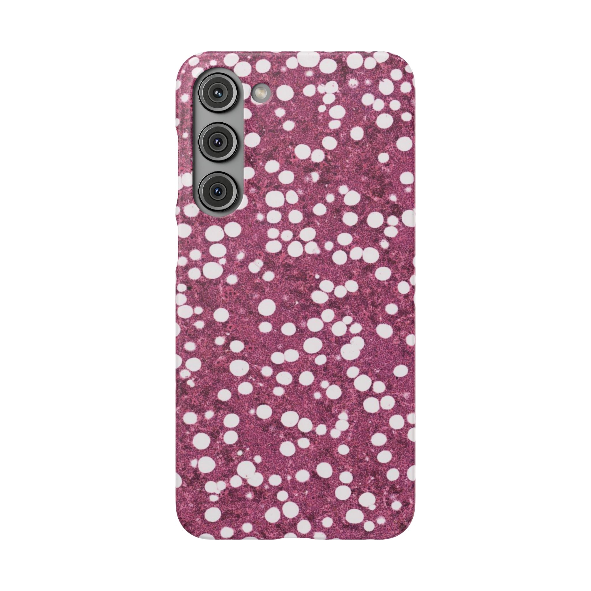Slim Case Myelolipom