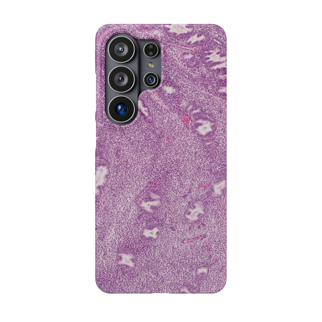 Slim Case Endometrium