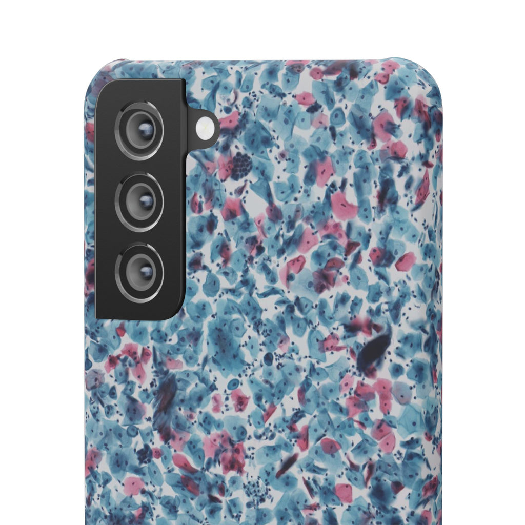 Slim Case PAP