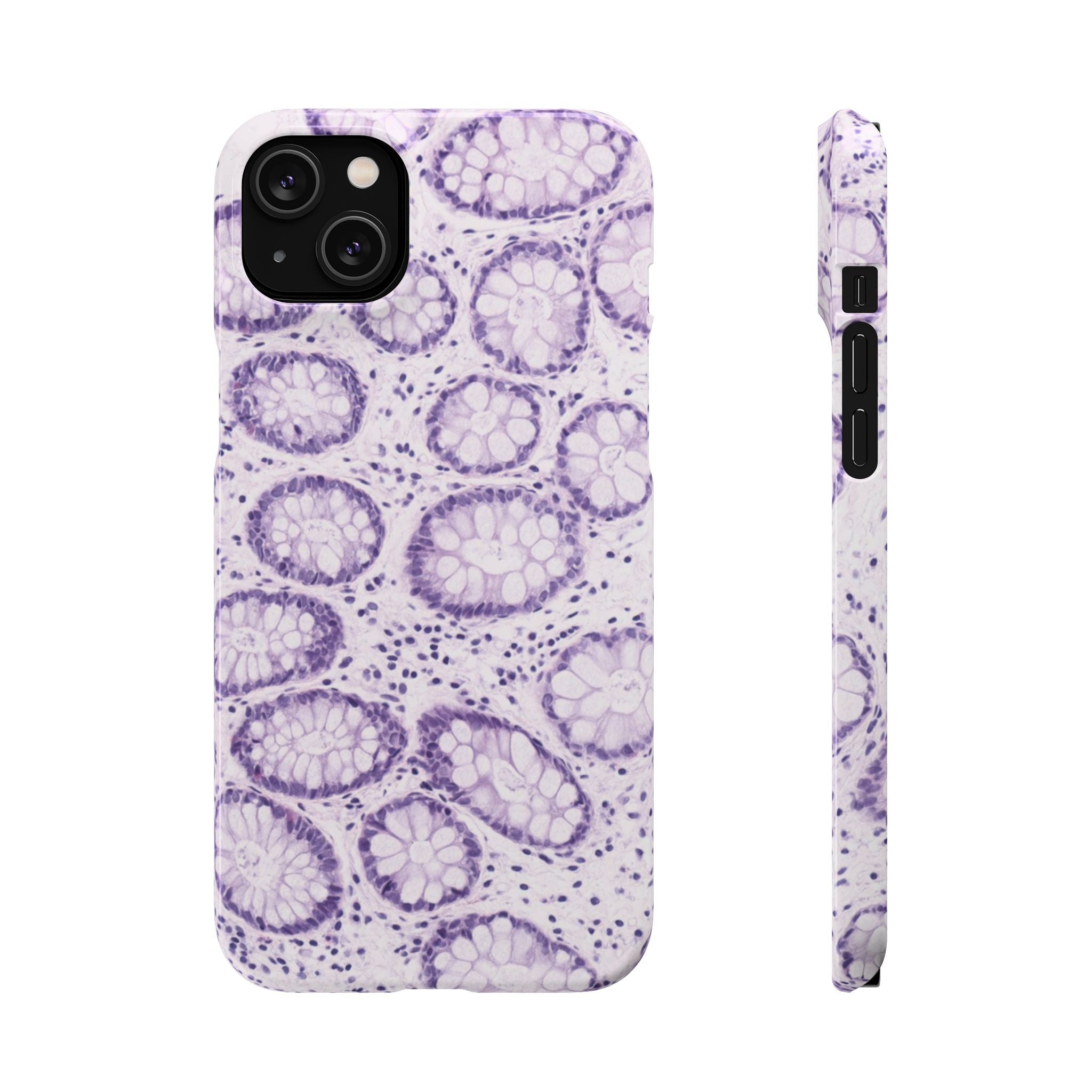 Slim Case Kolon