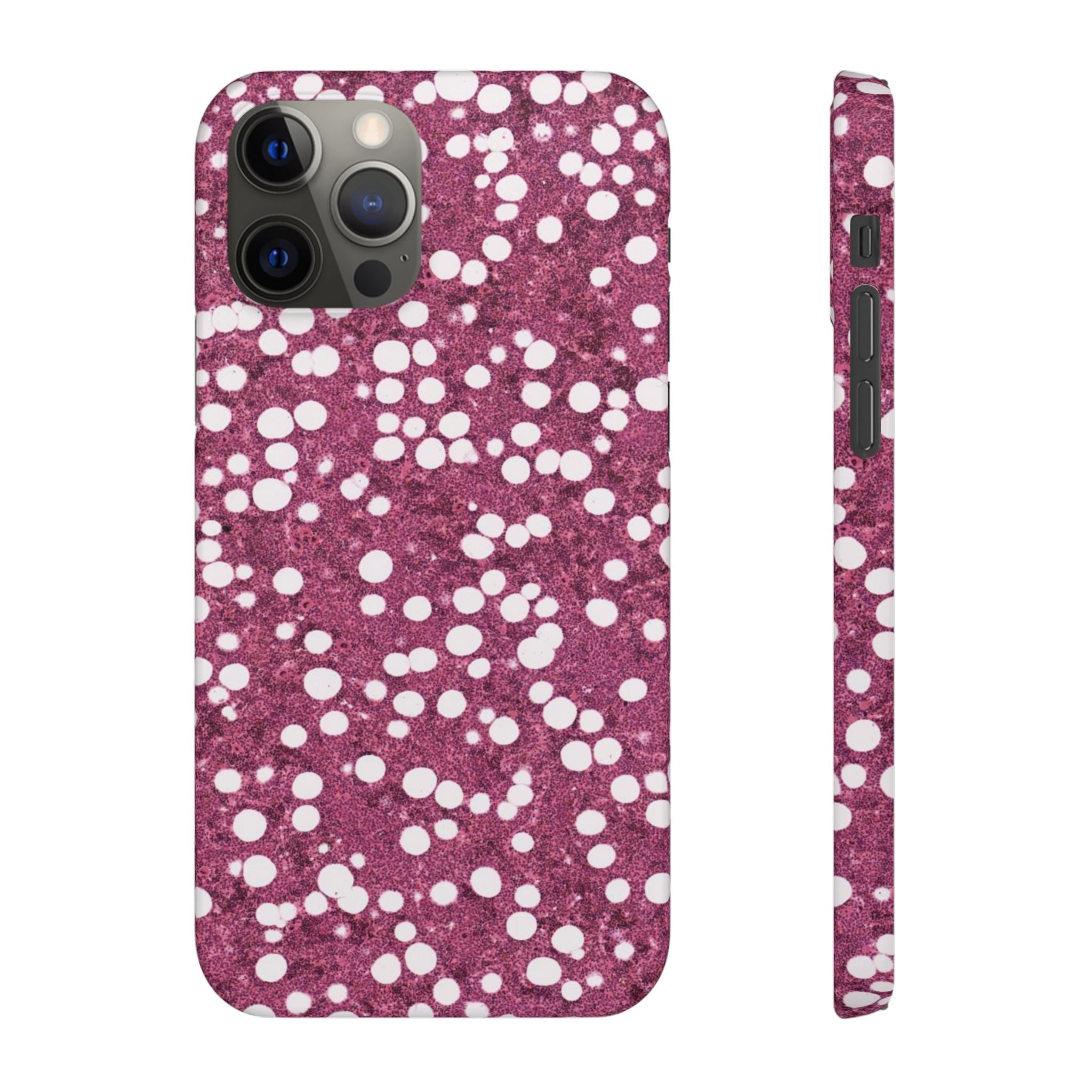 Slim Case Myelolipom