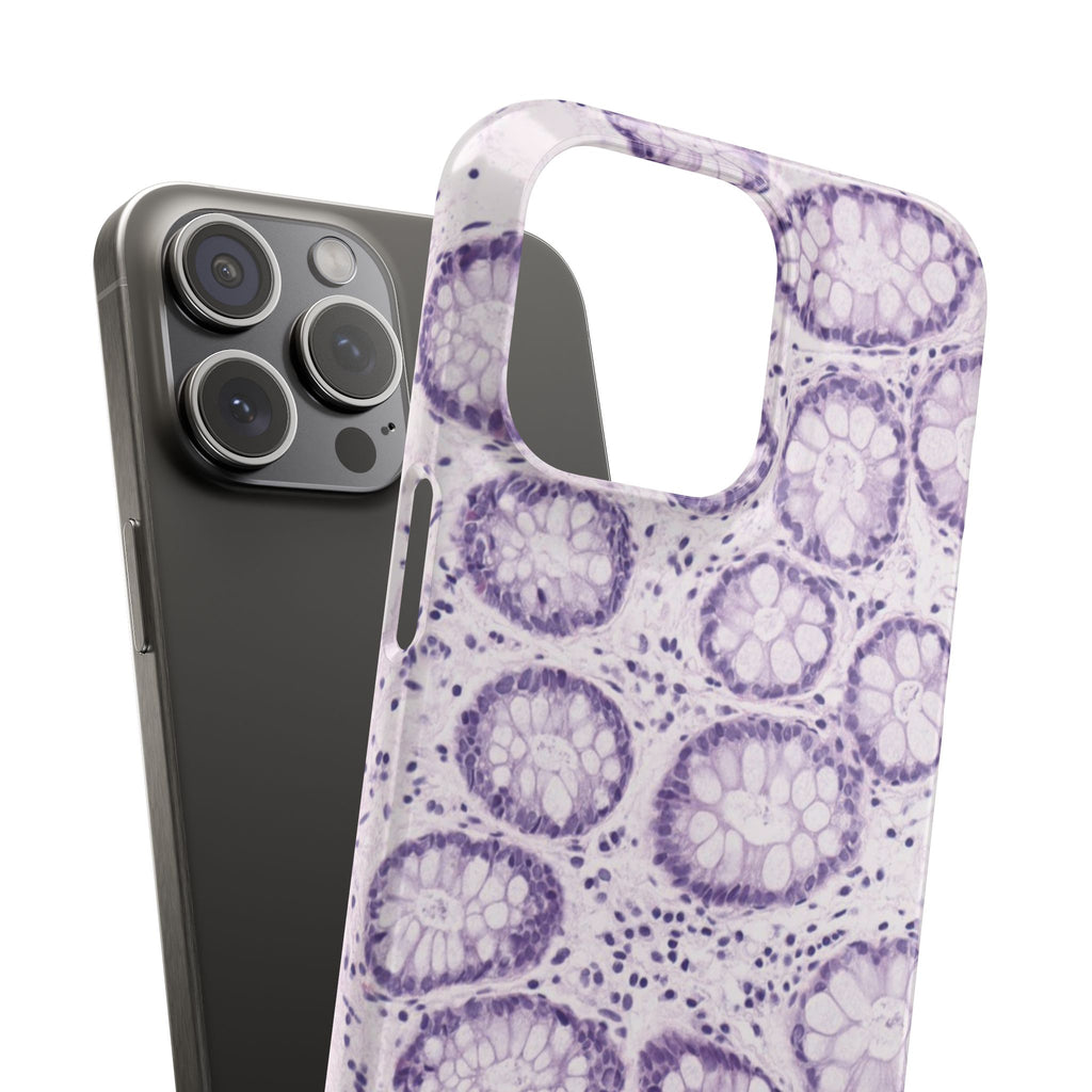 Slim Case Kolon