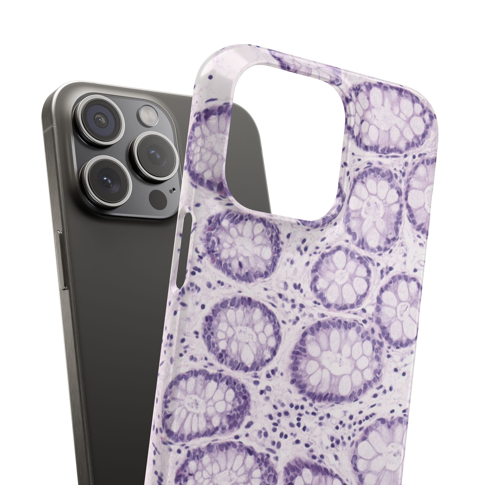 Slim Case Kolon