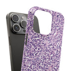 Slim Case Paraganglion