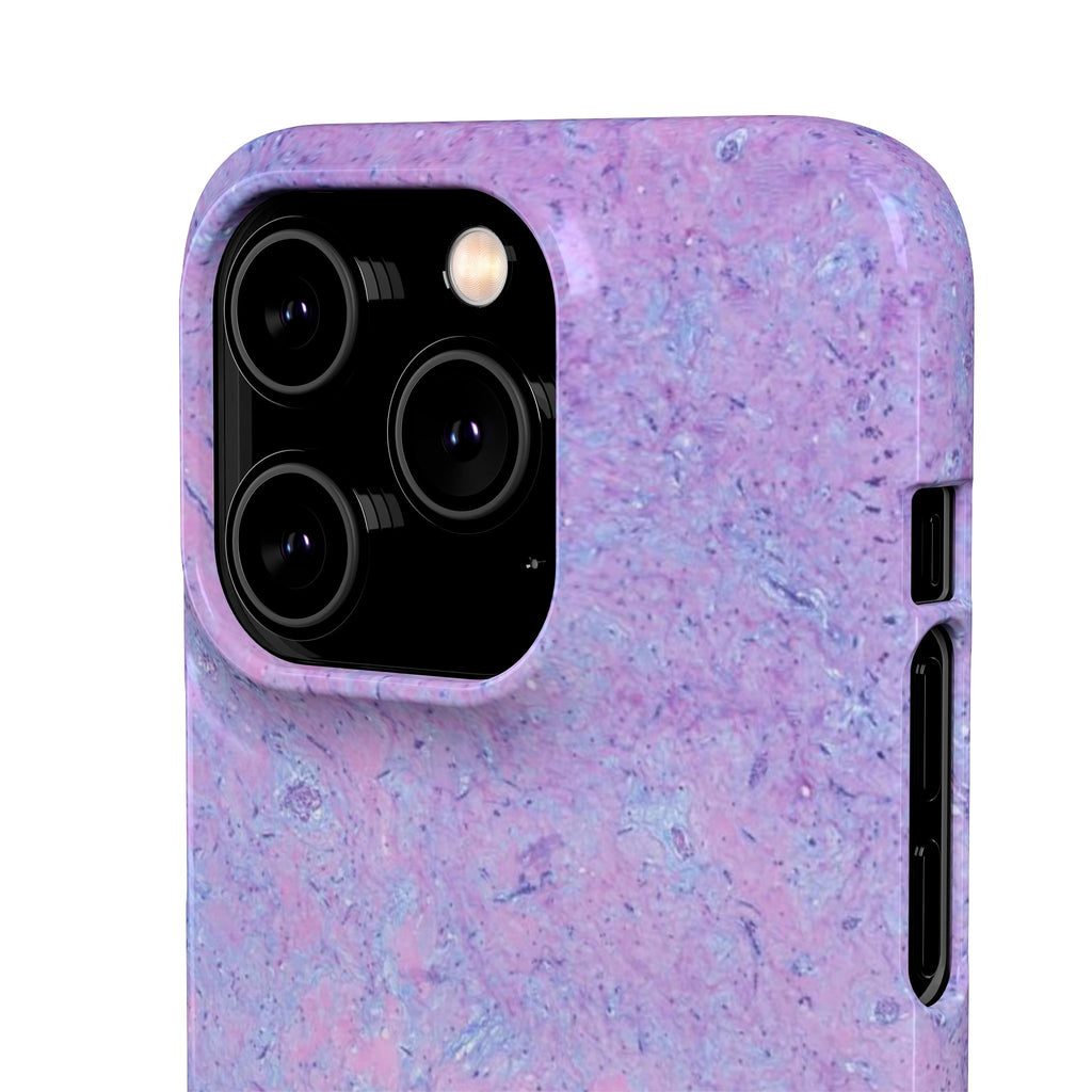 Slim Case Arterielles Myxom