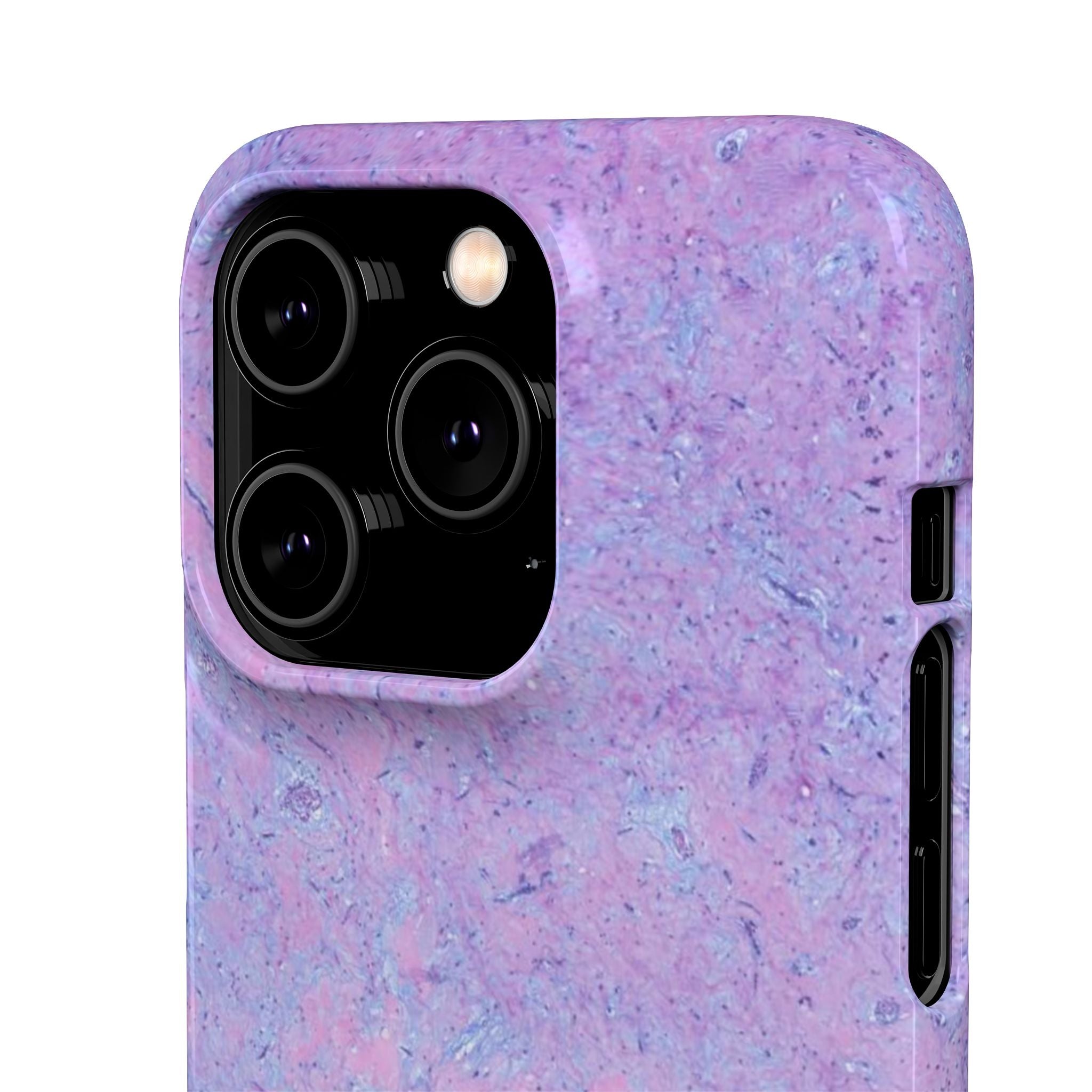 Slim Case Arterielles Myxom