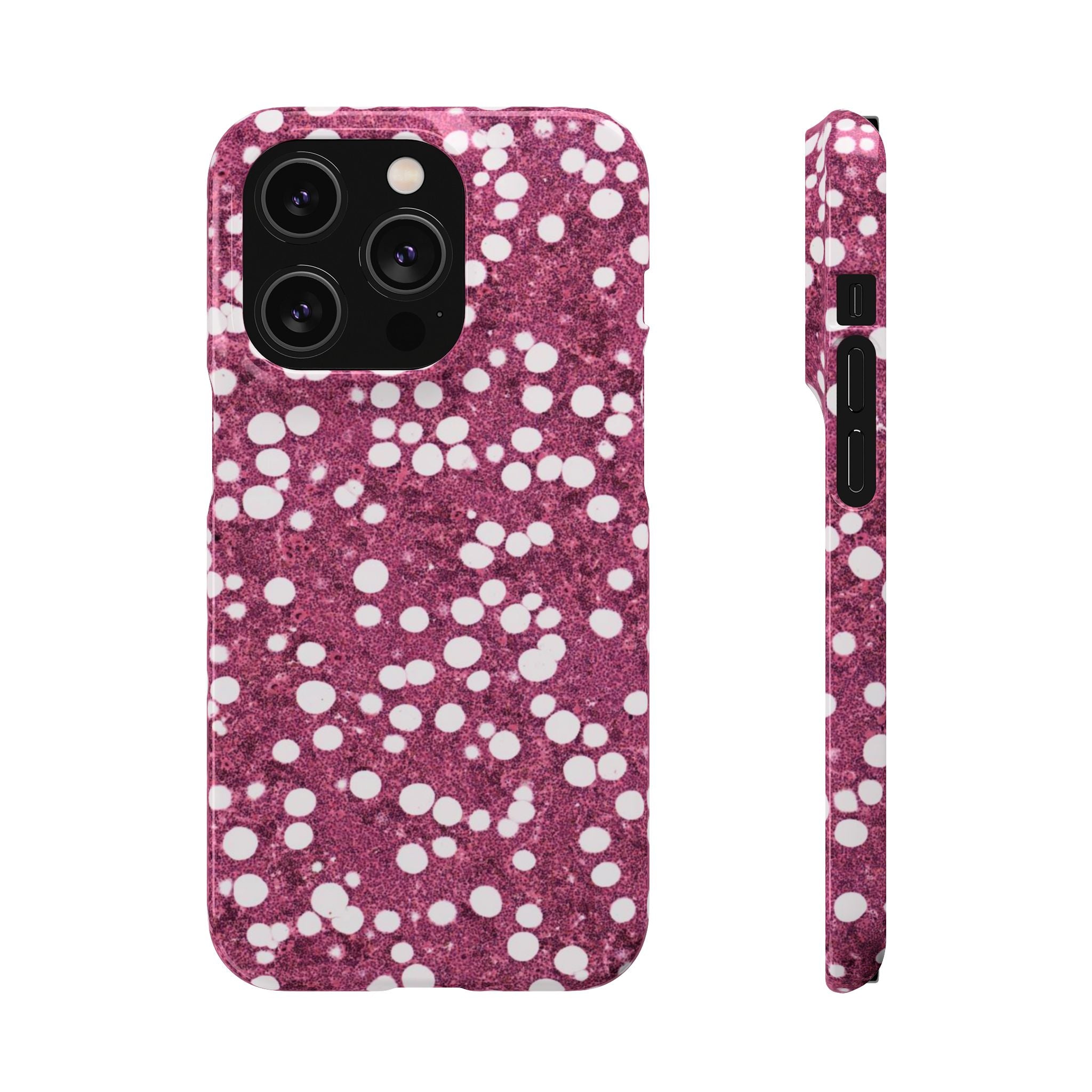 Slim Case Myelolipom