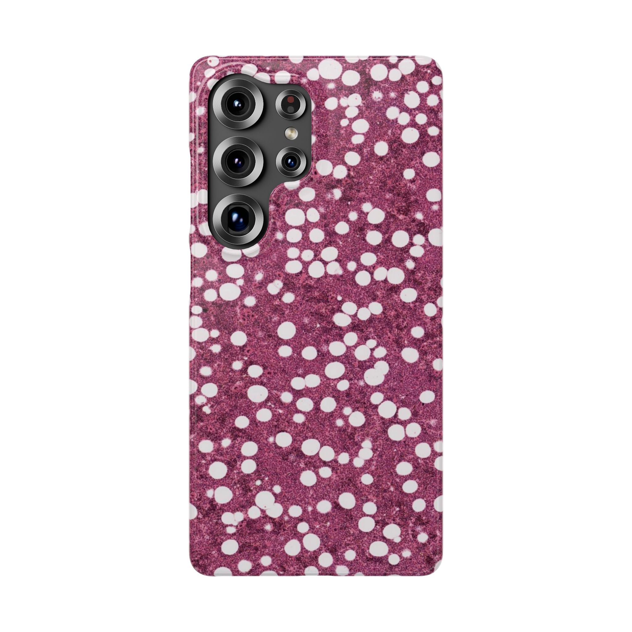 Slim Case Myelolipom