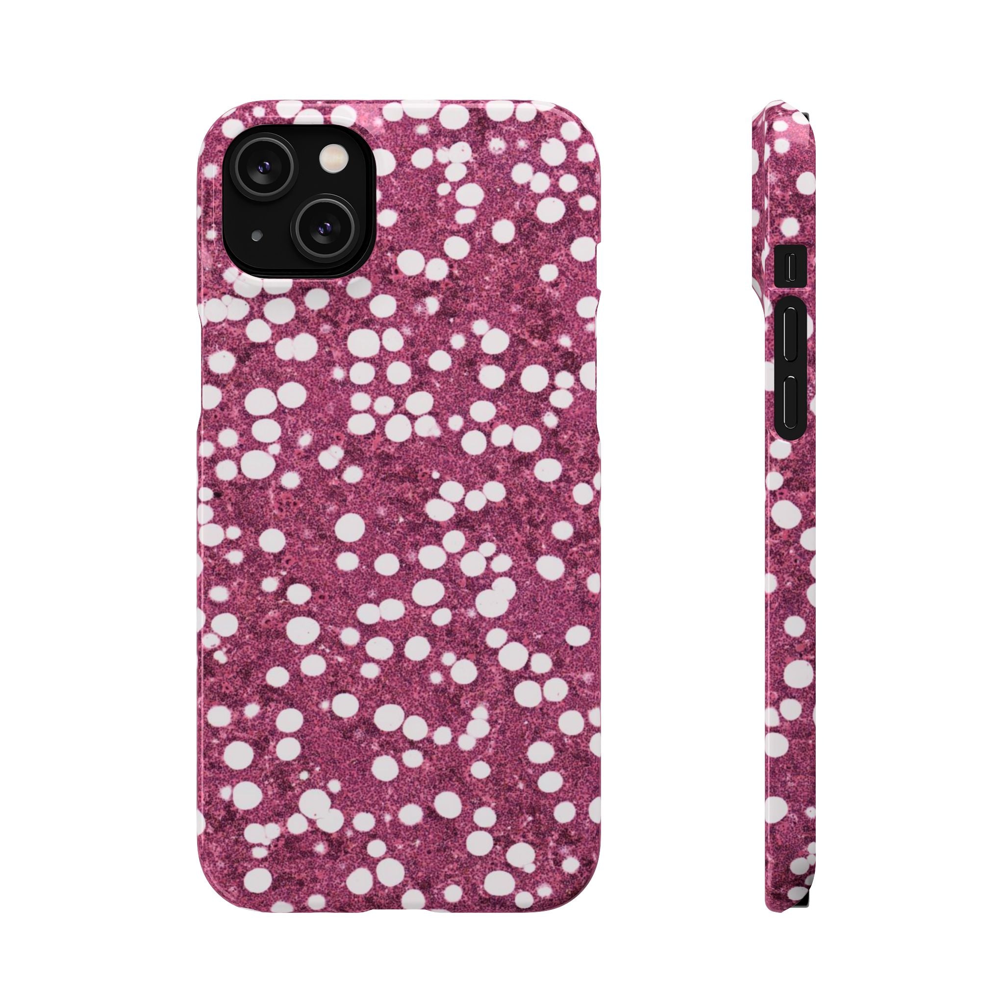 Slim Case Myelolipom
