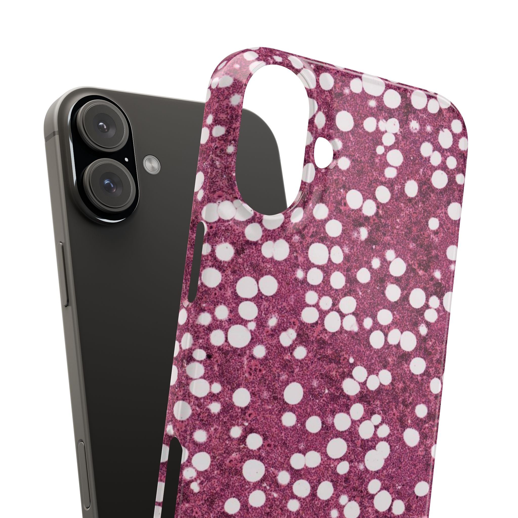 Slim Case Myelolipom