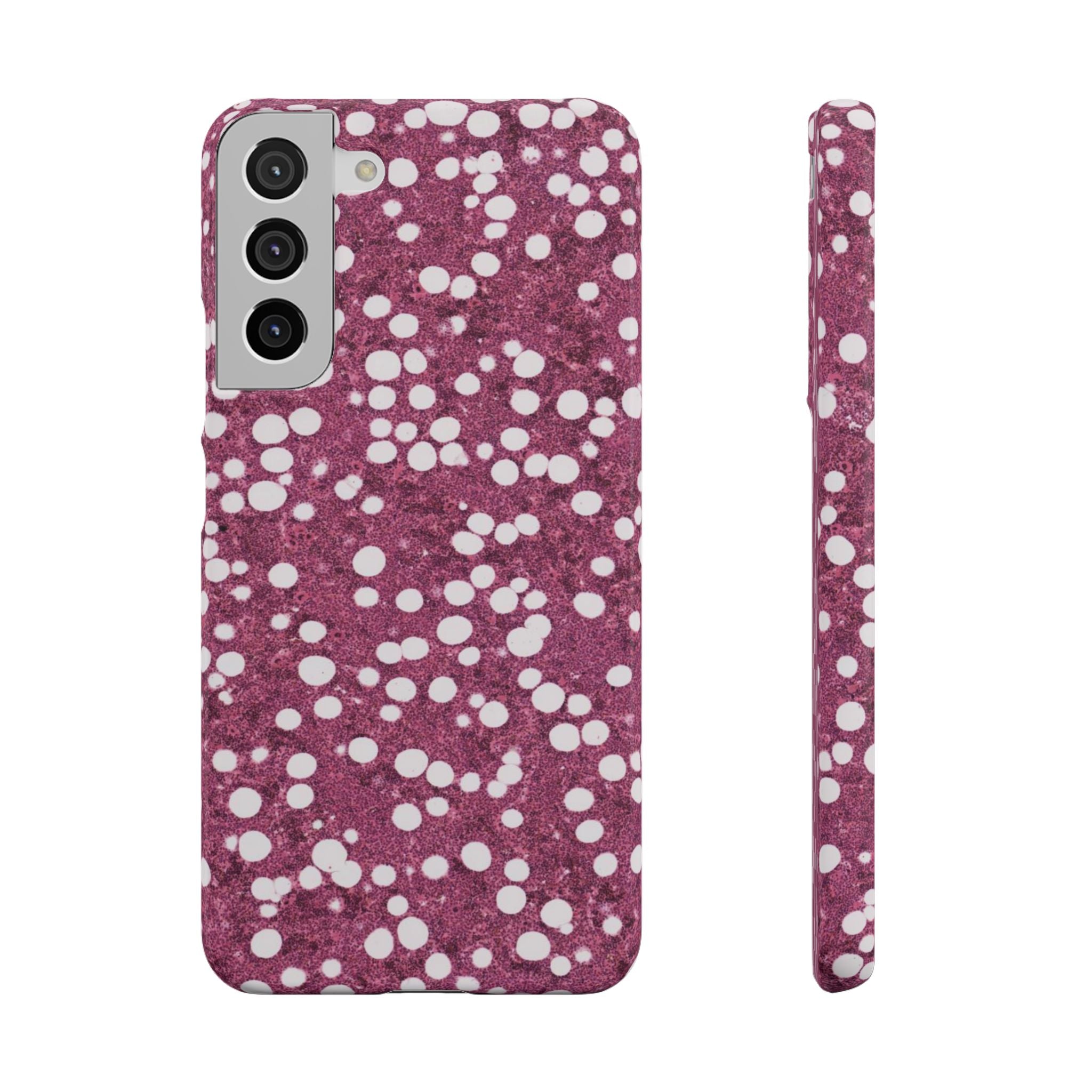 Slim Case Myelolipom