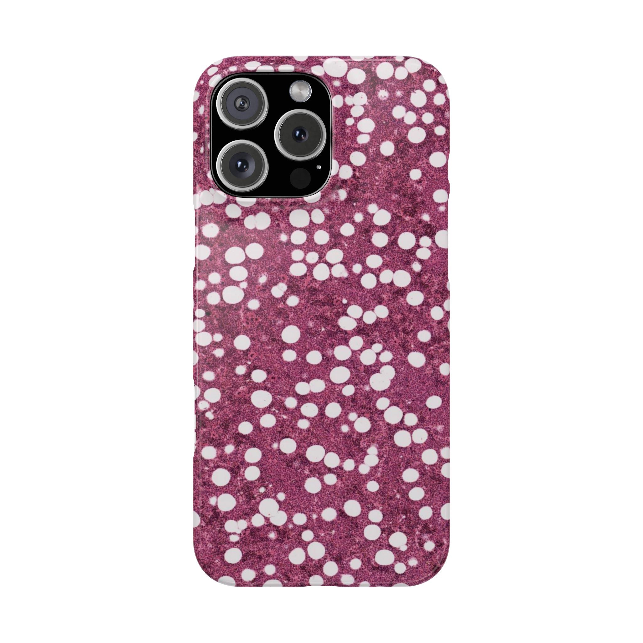 Slim Case Myelolipom