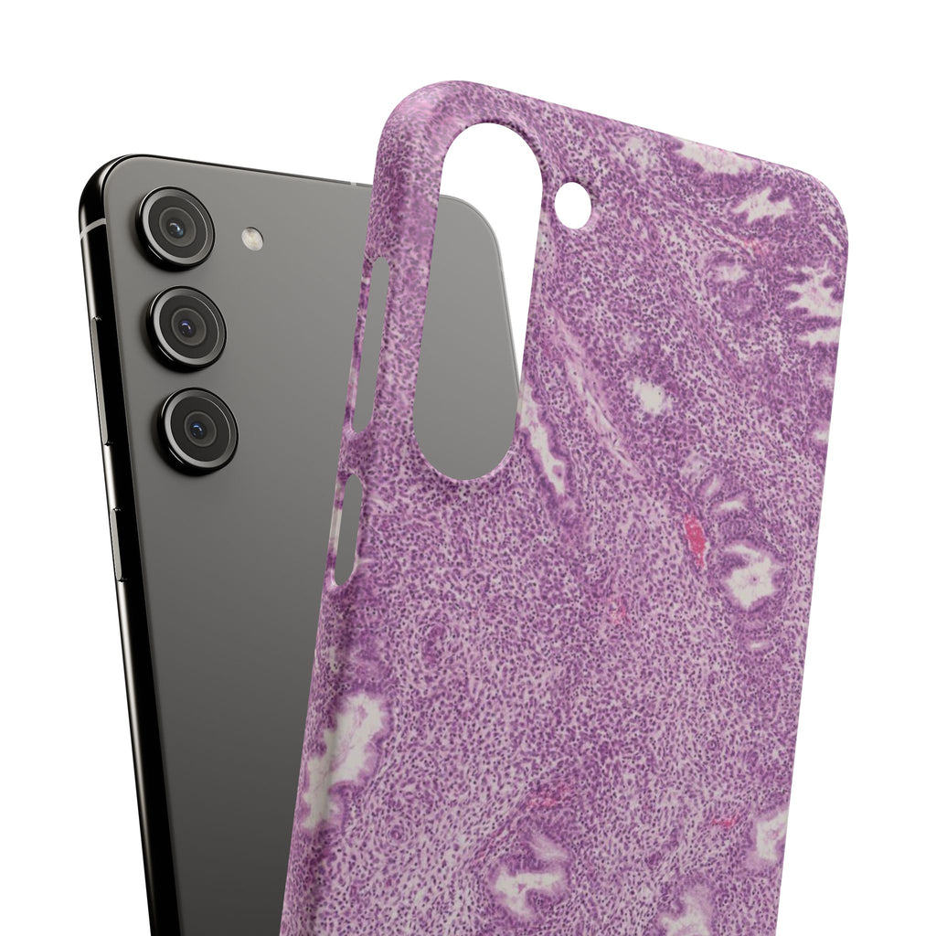 Slim Case Endometrium