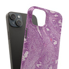 Slim Case Endometrium