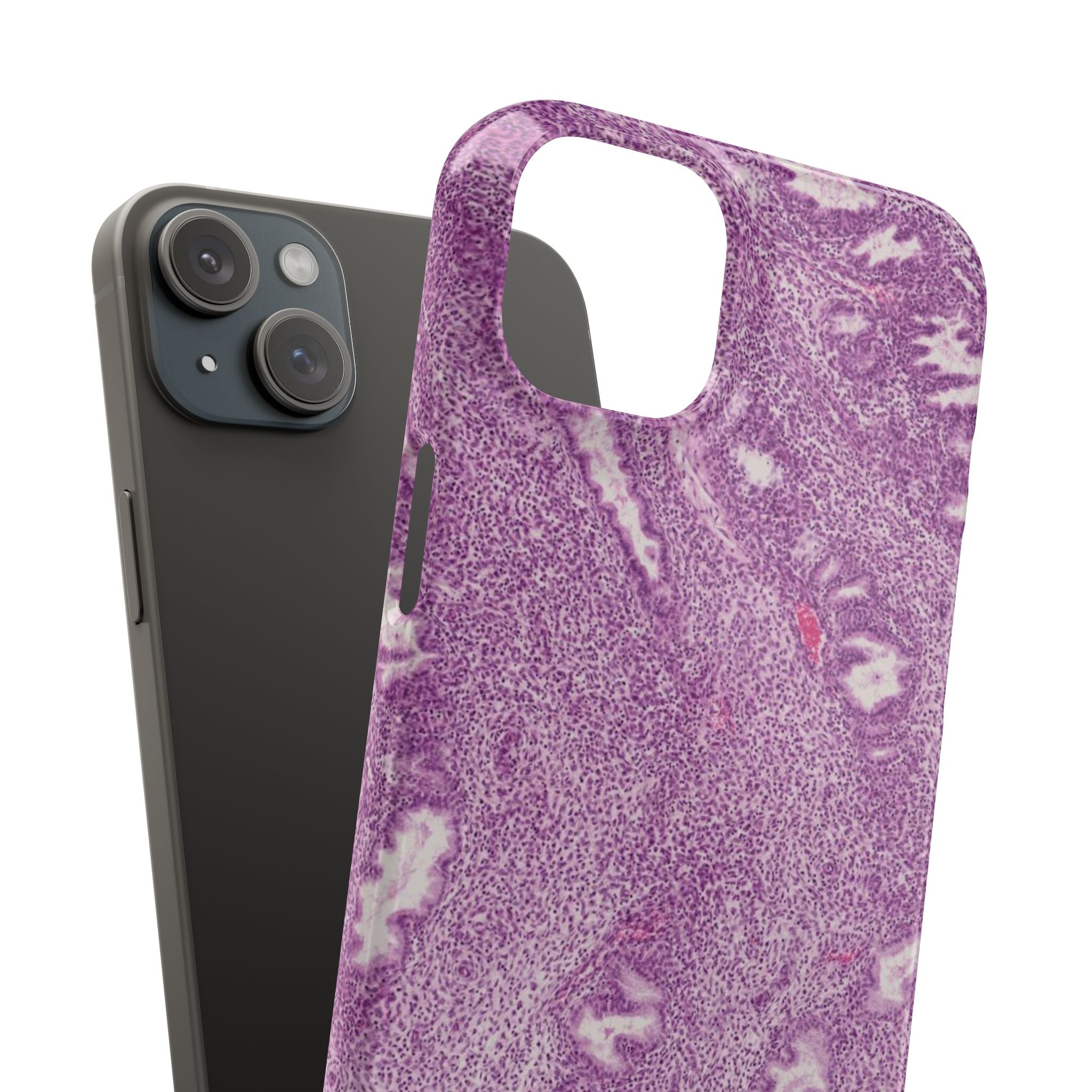 Slim Case Endometrium