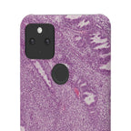 Slim Case Endometrium