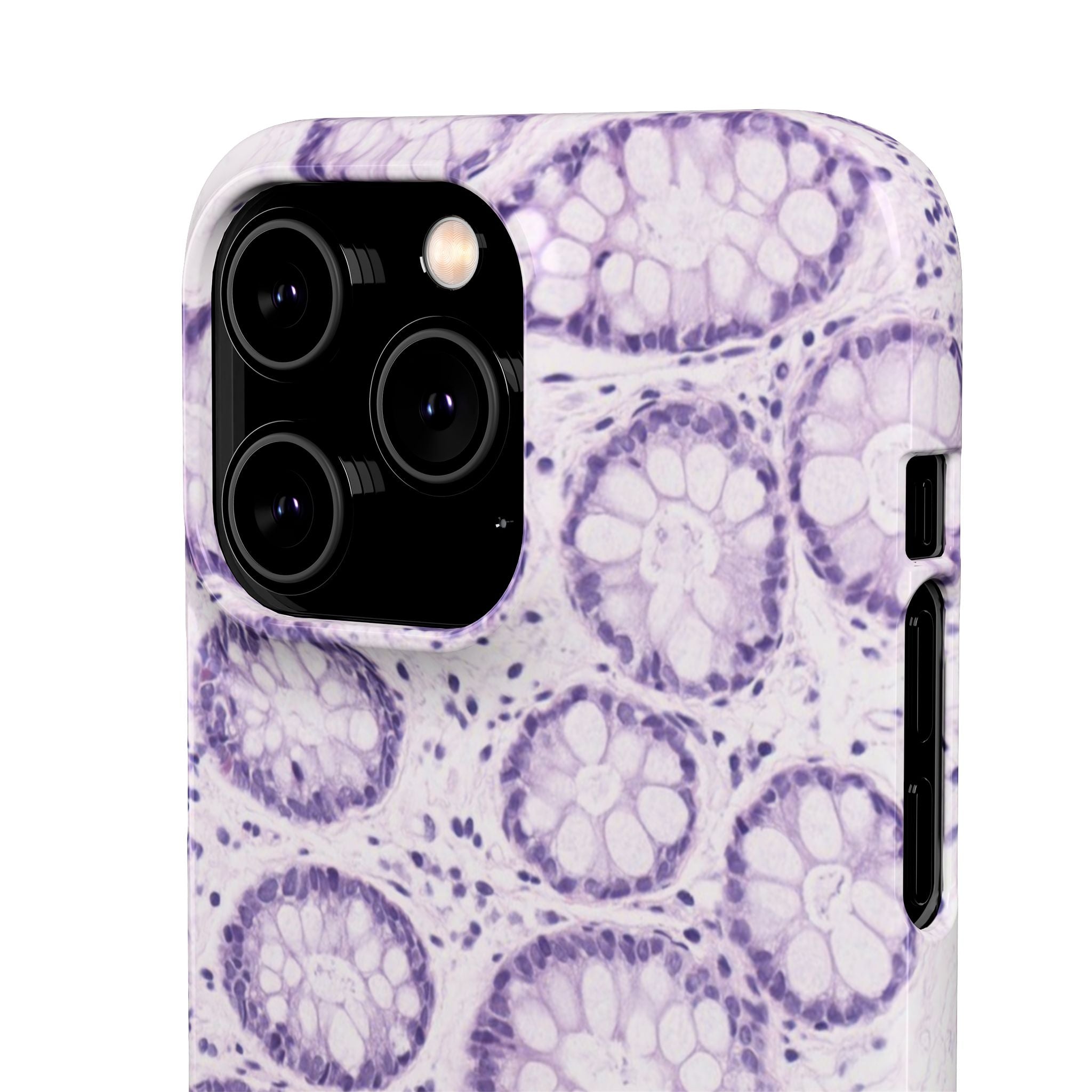 Slim Case Kolon