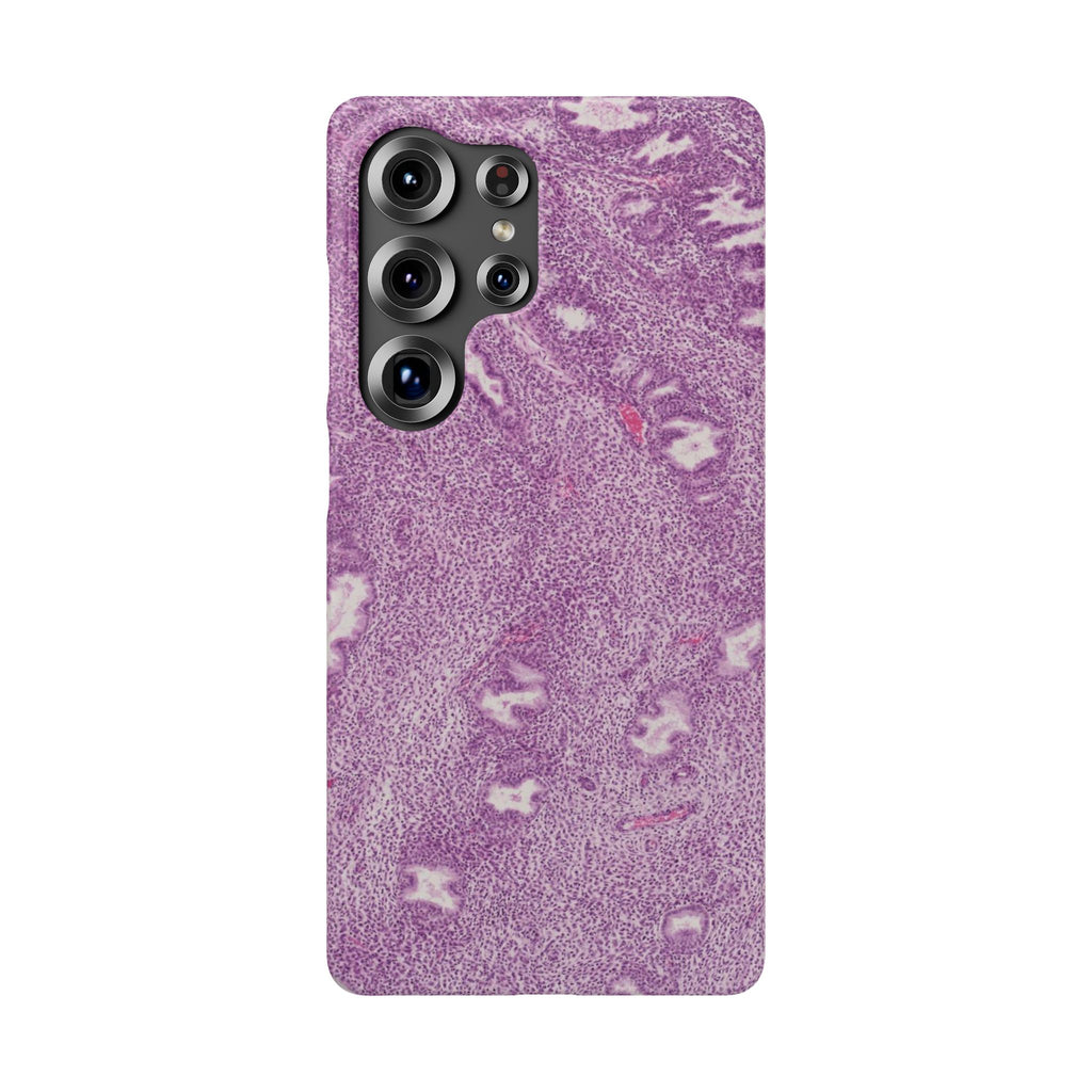 Slim Case Endometrium
