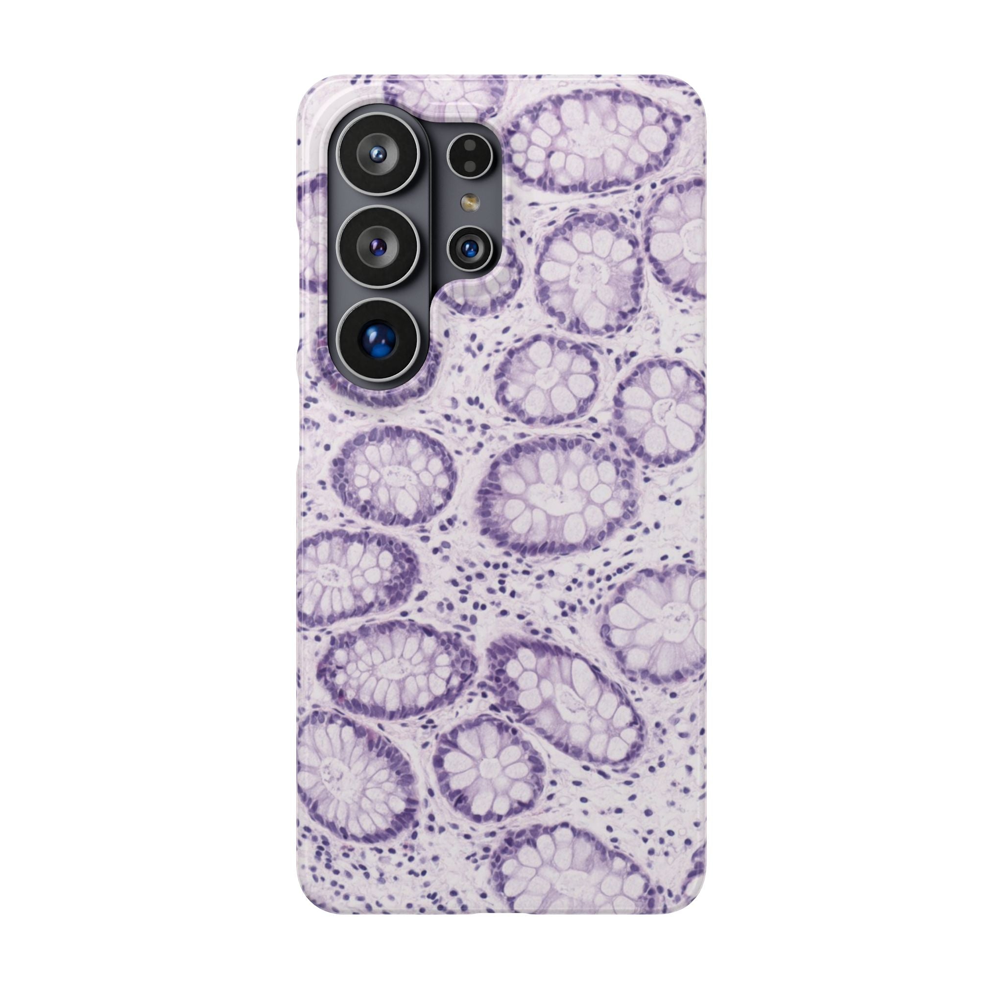 Slim Case Kolon