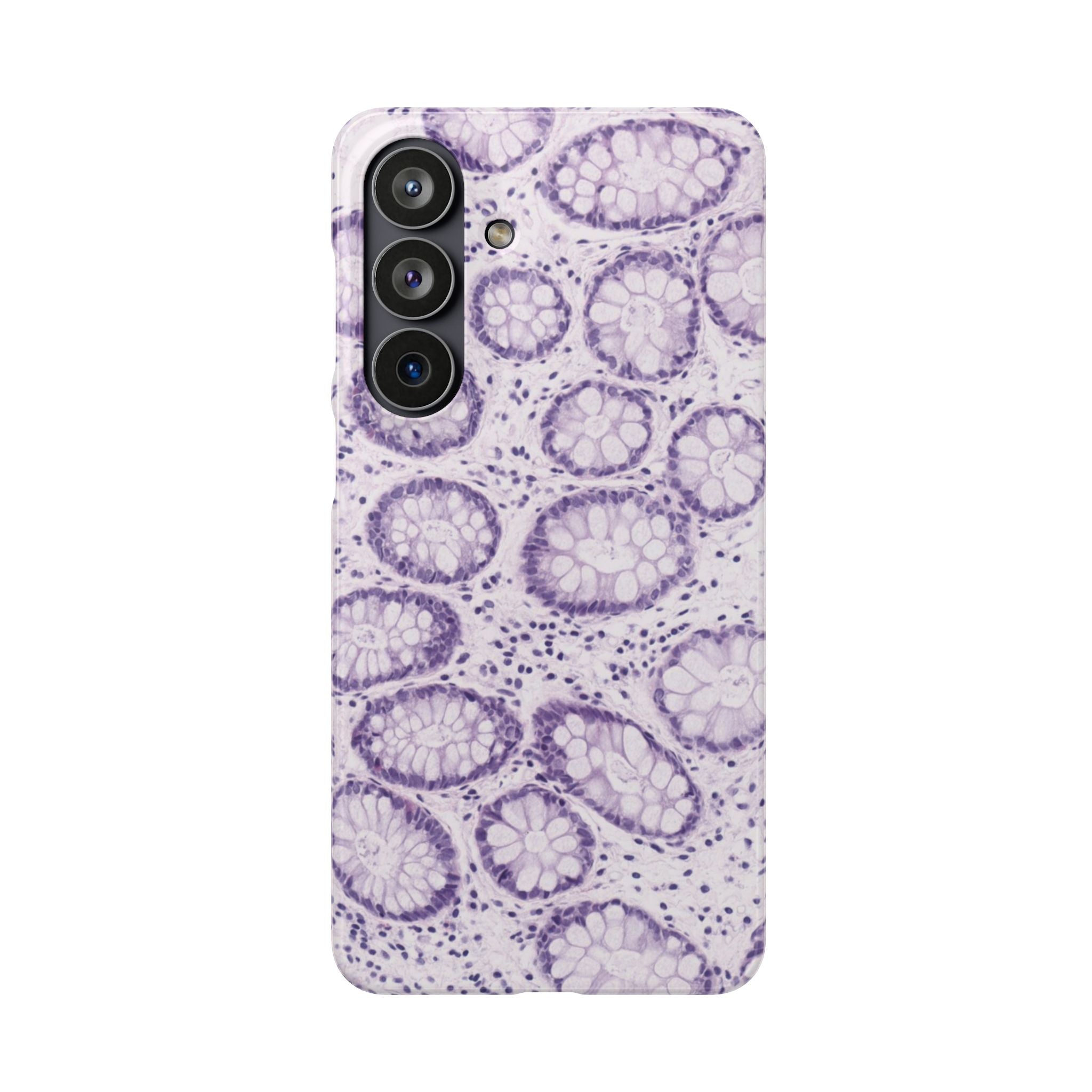 Slim Case Kolon