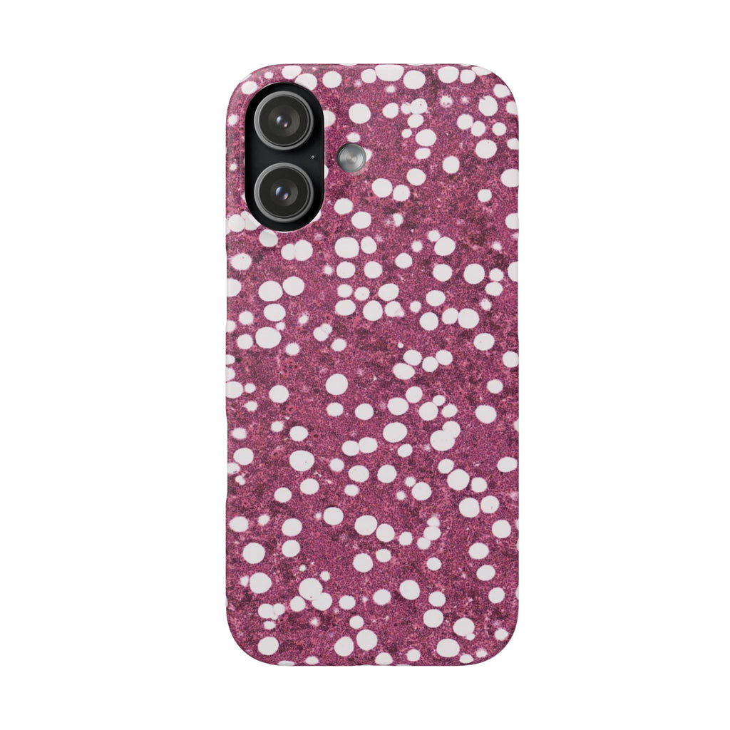 Slim Case Myelolipom